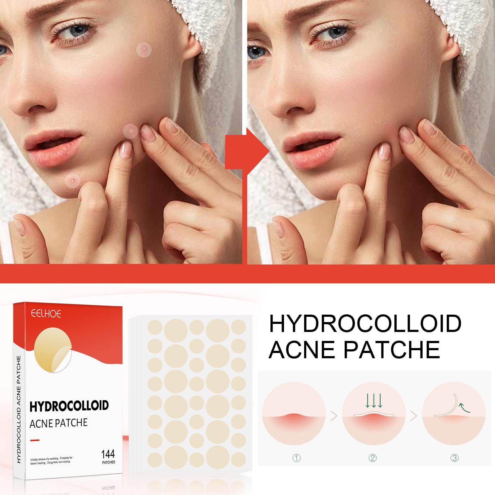 Pimple Patch for Shrinking Zits and Whiteheads in 1 use; Nighttime Spot Stickers for Face and Skin Treatment for Breakouts, Absorbs Zits & Blemish Acne Patches, Hydrocolloid Patches
