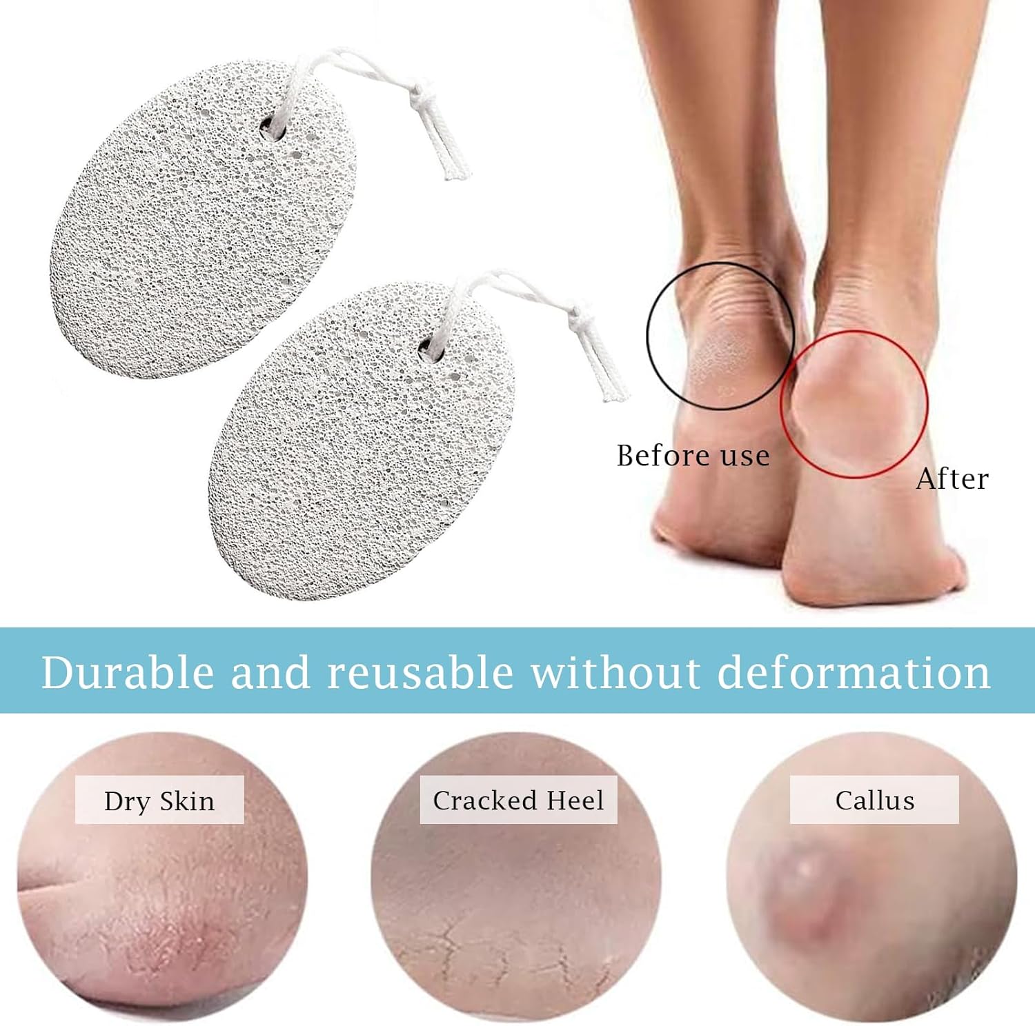 【Clearance Sale】Pumice Stone 2 Pcs - Foot Pumice Stone for Feet Hard Skin Remover, Foot Scrubber Stone for Dead Skin, Calluses and Corns