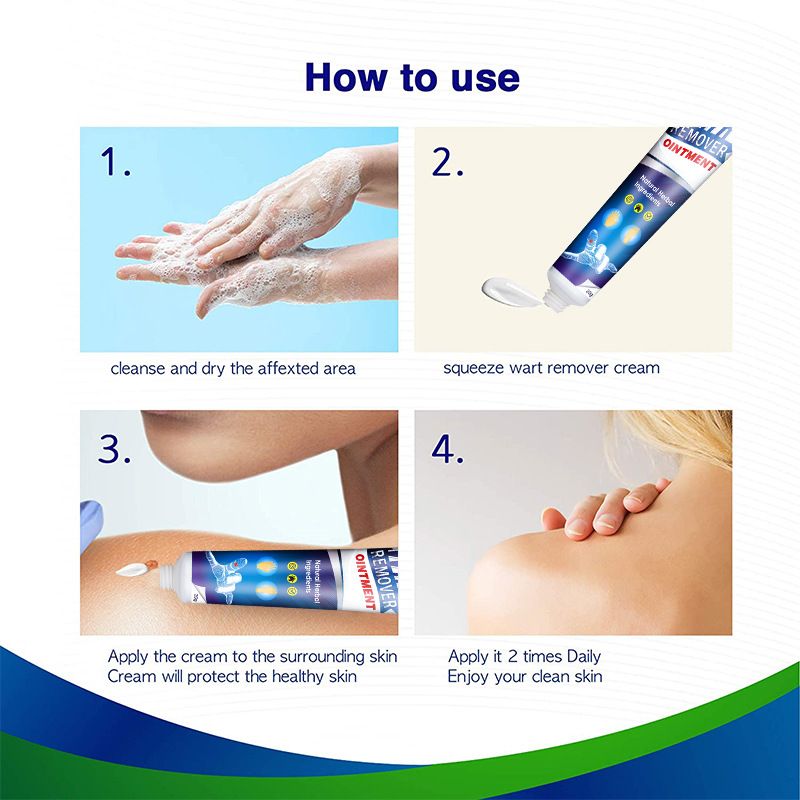 Sumifun Skin Tag Remover, 20g Wart Removal Cream for Effective and Safe Results. Gently Removes Corns on Feet and Hands, Keeps Skin Smooth and Healthy