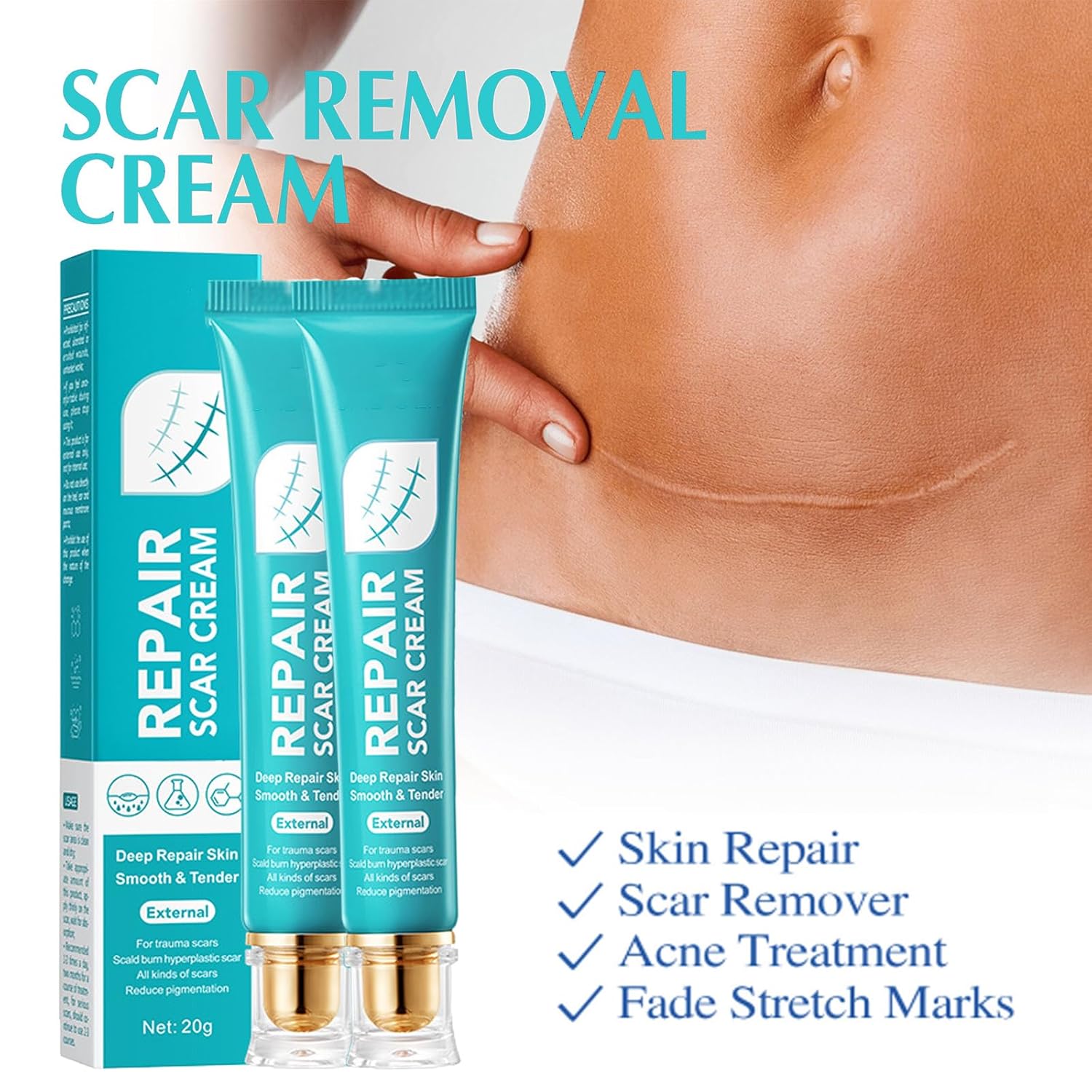 SADOER Scar Cream For Men And Women, Repair Skin Scar Cream,Facial Advance Silicone Removal Scar Gel Away Gel For Surgical Scars