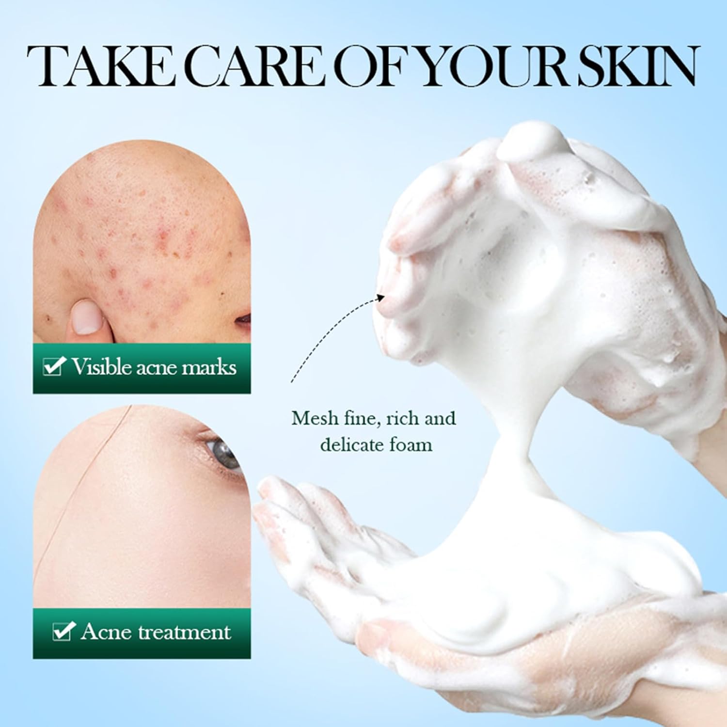 【Clearance Sale】SADOER Tea Tree Facial Cleanser Whitening Deep Cleansing Oil Control Moisturizing Face Wash Hot Selling Mild 100g