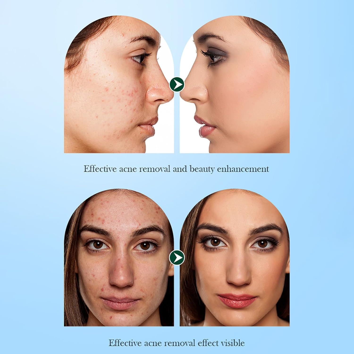 【Clearance Sale】SADOER Tea Tree Facial Cleanser Whitening Deep Cleansing Oil Control Moisturizing Face Wash Hot Selling Mild 100g