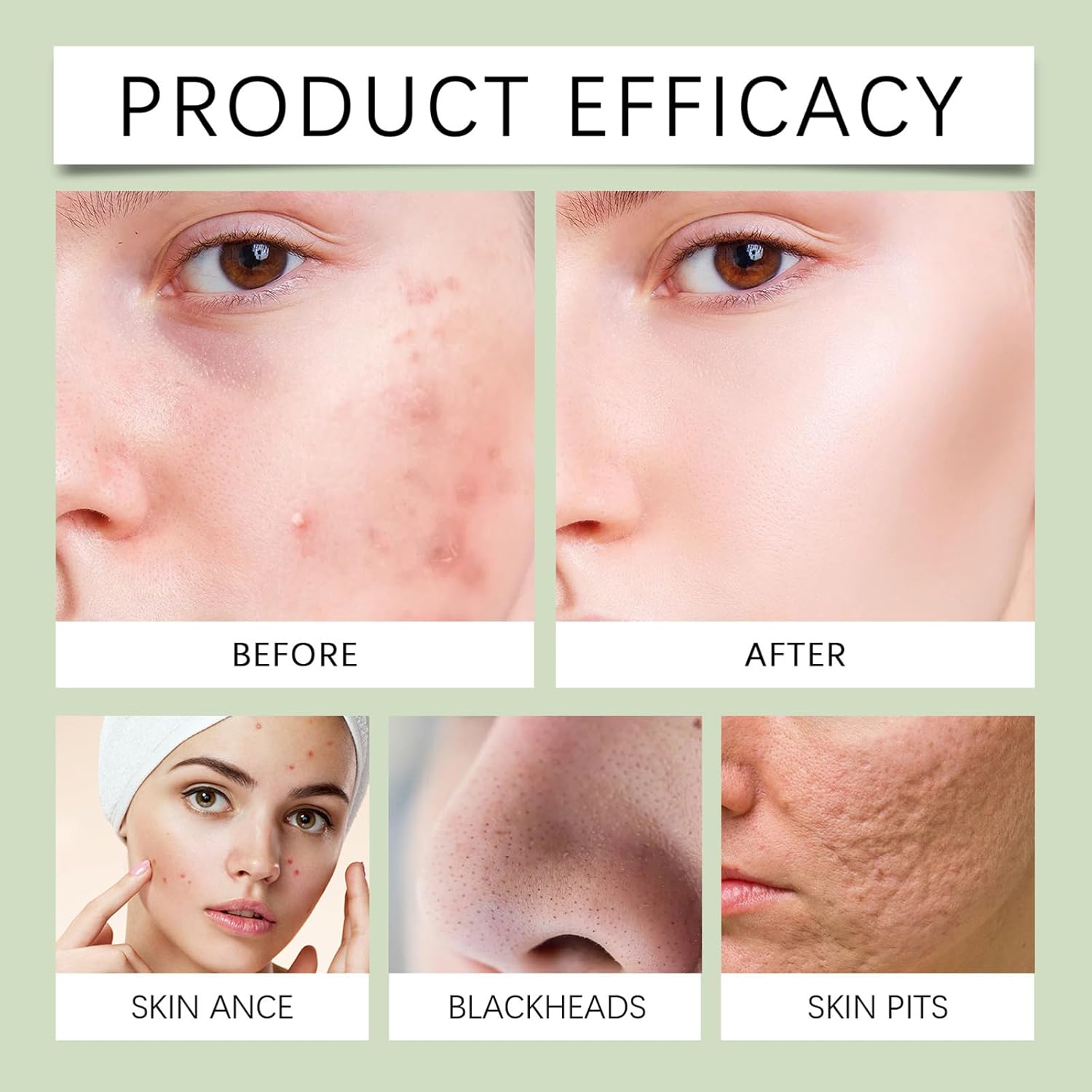 【Clearance Sale】SADOER Tea Tree Facial Cleanser Whitening Deep Cleansing Oil Control Moisturizing Face Wash Hot Selling Mild 100g