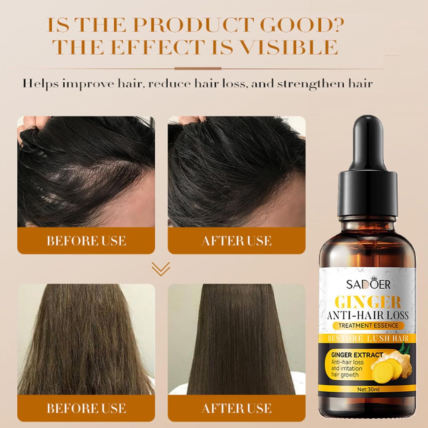 【Clearance Sale】SADOER Ginger Hair Treatment Oil, Hair Repair and Growth Serum for Dry, Damaged & Coarse Hair, Hair Essential Oil for All Hair Types