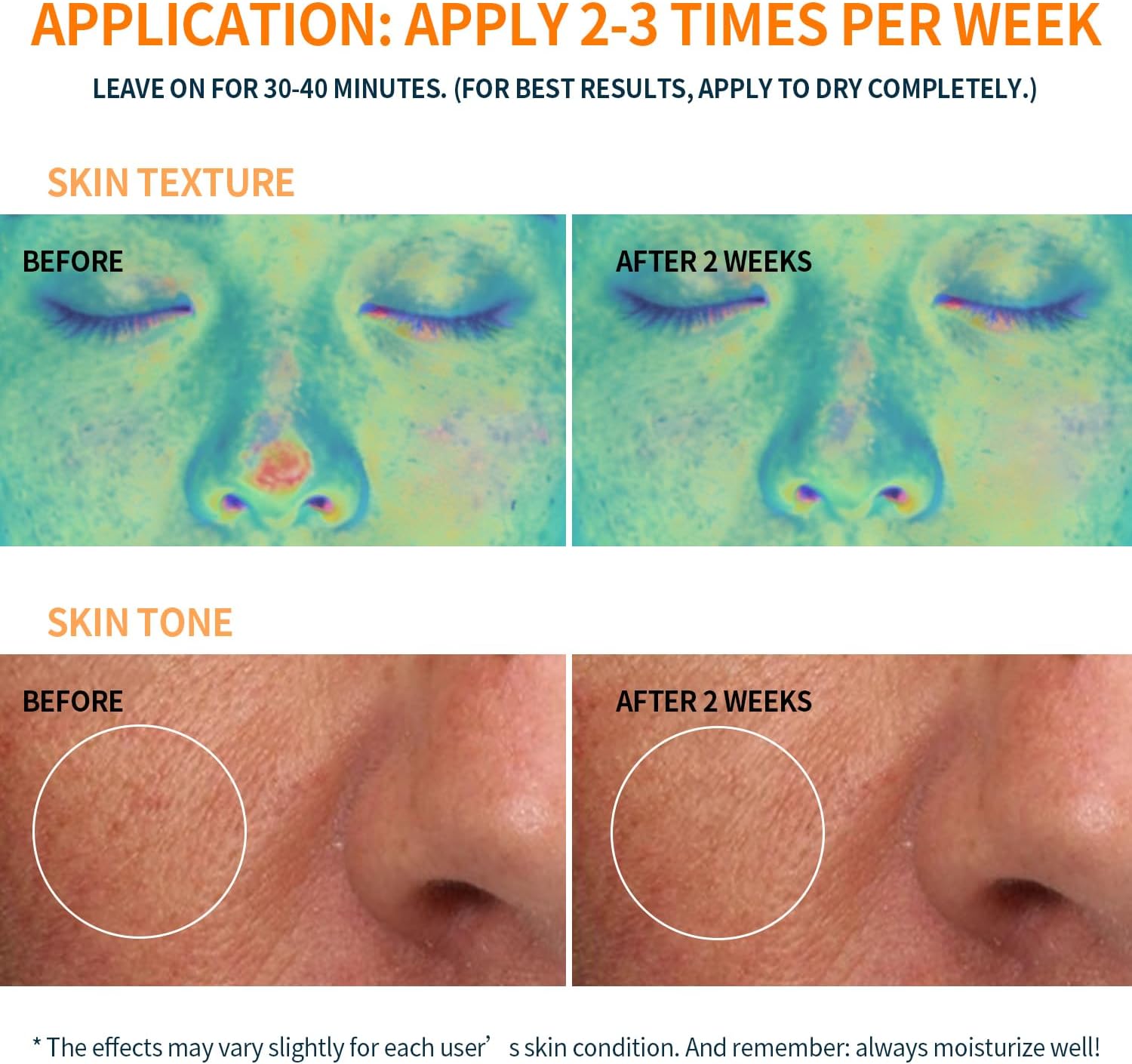 【Clearance Sale】Firming Face Sheet Masks (5 Sheets) With Hyaluronic Acid And Peptides, Anti Wrinkle, Moisturising & Hydrating face mask, Sheet Face Mask Skincare