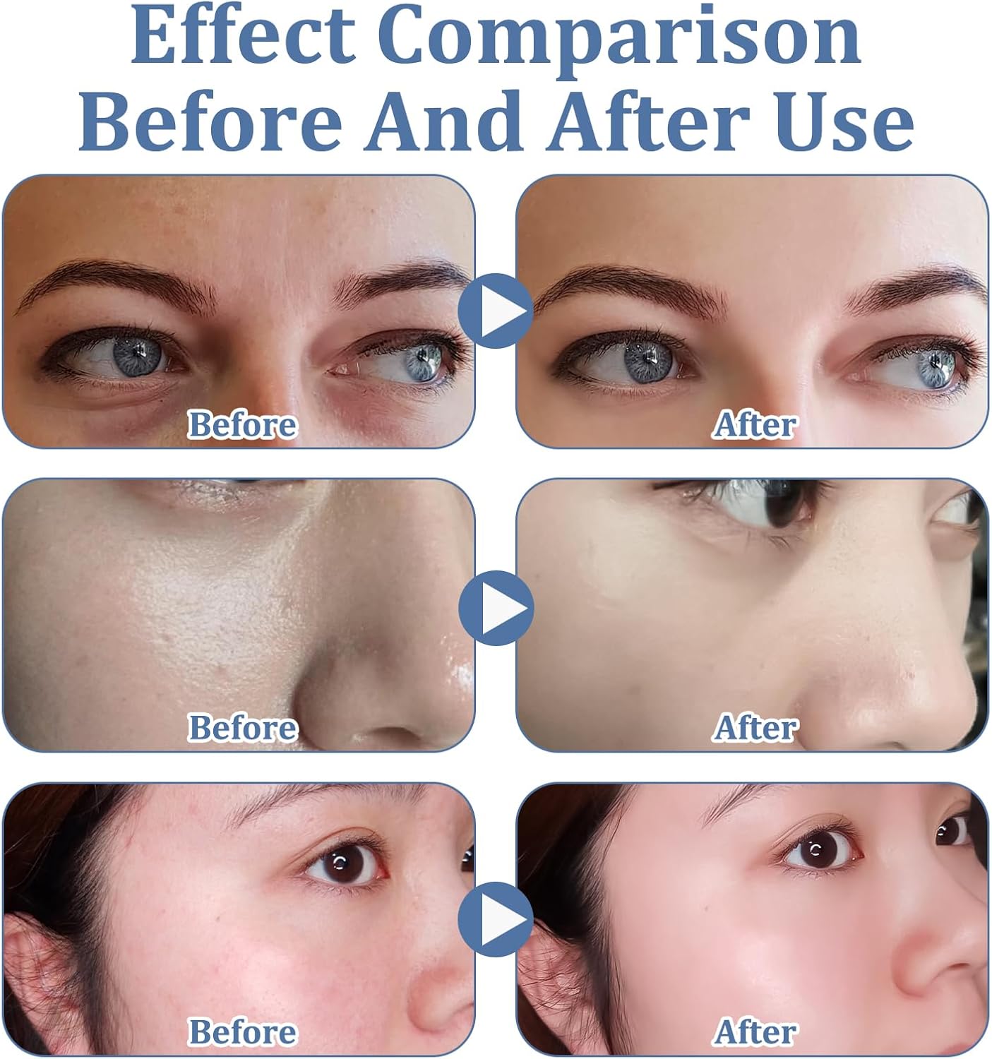 【Clearance Sale】Firming Face Sheet Masks (5 Sheets) With Hyaluronic Acid And Peptides, Anti Wrinkle, Moisturising & Hydrating face mask, Sheet Face Mask Skincare