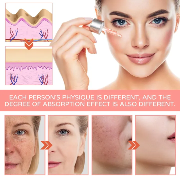 1pc, 5 In 1 Facial Serum, Moisturizing Smoothing Wrinkle Vitamin C Hyaluronic Acid Face Serum, Shrink Pores Serum, Skin Care