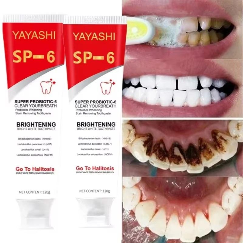 SP-6 probiotic toothpaste whitens teeth, eliminates plaque stains, whitens teeth, promotes oral hygiene, freshens breath, Denta 120g