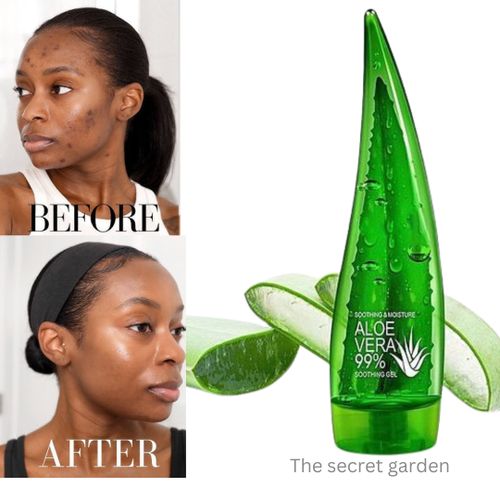 Dr.Dess Aloe Vera Soothing Gel Sunburn Repair Gel 99% Natural AloeVera Content Treat Sun Burns and Repairs Skin Faster Hydrating and Moisturizing gel