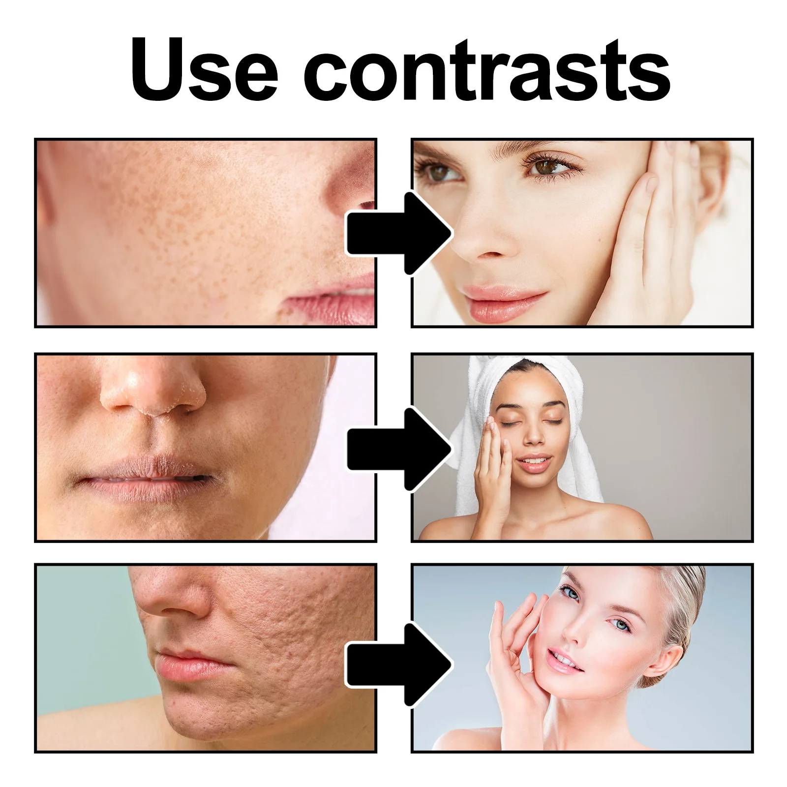 West&Month 50g Purifying Exfoliating Gel Cleaning Pores Blackhead Dark Dead Skin Remover Repair Cleans Dirt Oil Face Body Gel