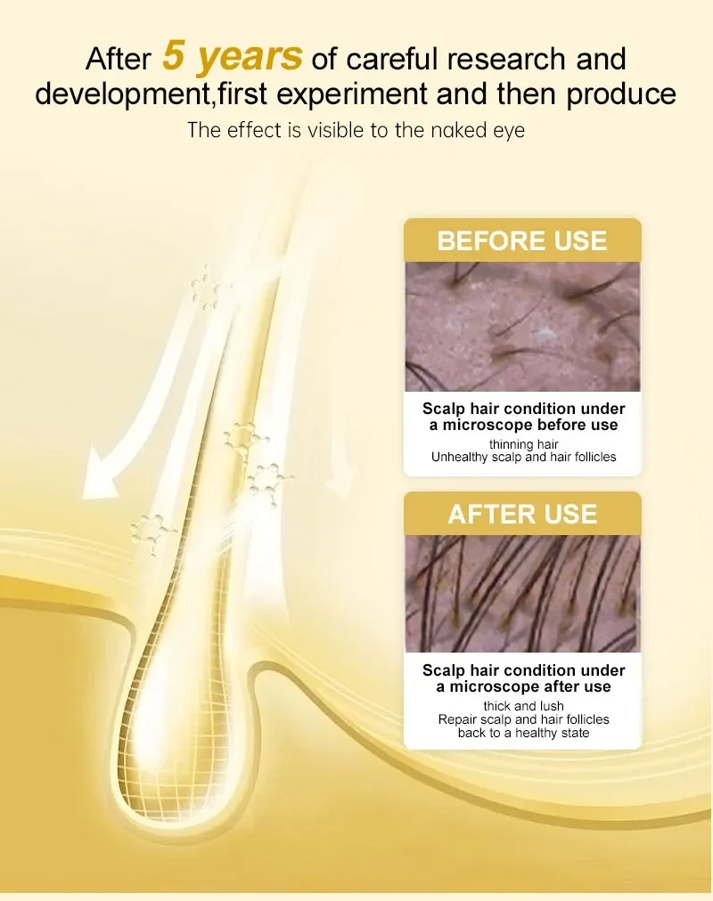 EELHOE Ginger Hair Growth Serum Sprayer Hair Regrowth s Grow Thicker Longer Hair Accelerate Growth For Men And Women