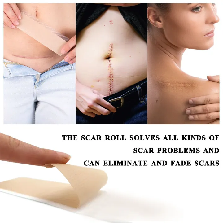 2Roll Silicone Scar Sheets Keloid Bump Removal Strips, Scar Reducing Treatments Surgical Scars,Burn,Tummy Tucks,Acne,C-Section