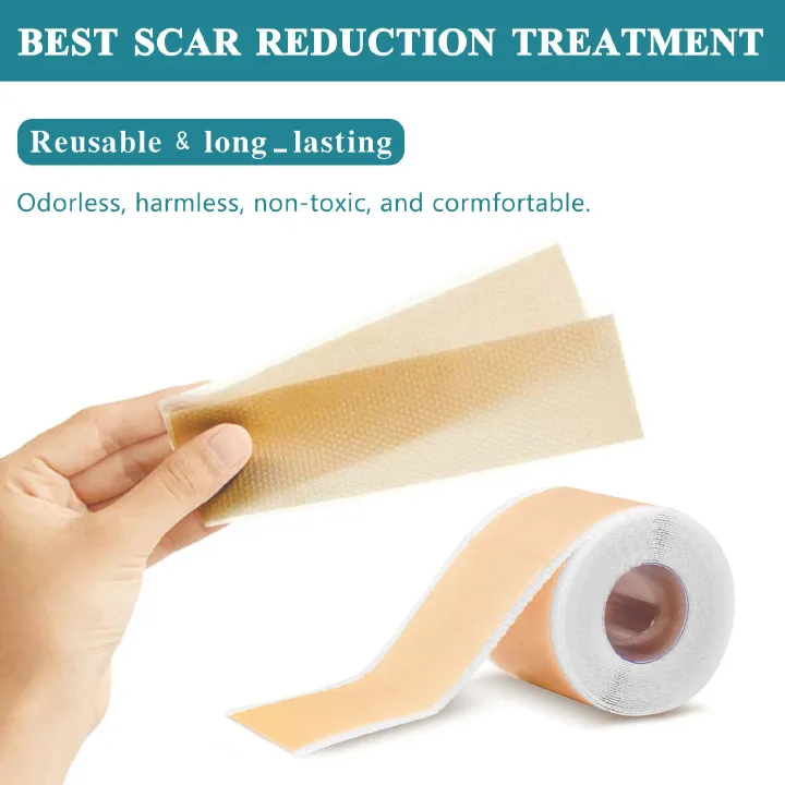 2Roll Silicone Scar Sheets Keloid Bump Removal Strips, Scar Reducing Treatments Surgical Scars,Burn,Tummy Tucks,Acne,C-Section