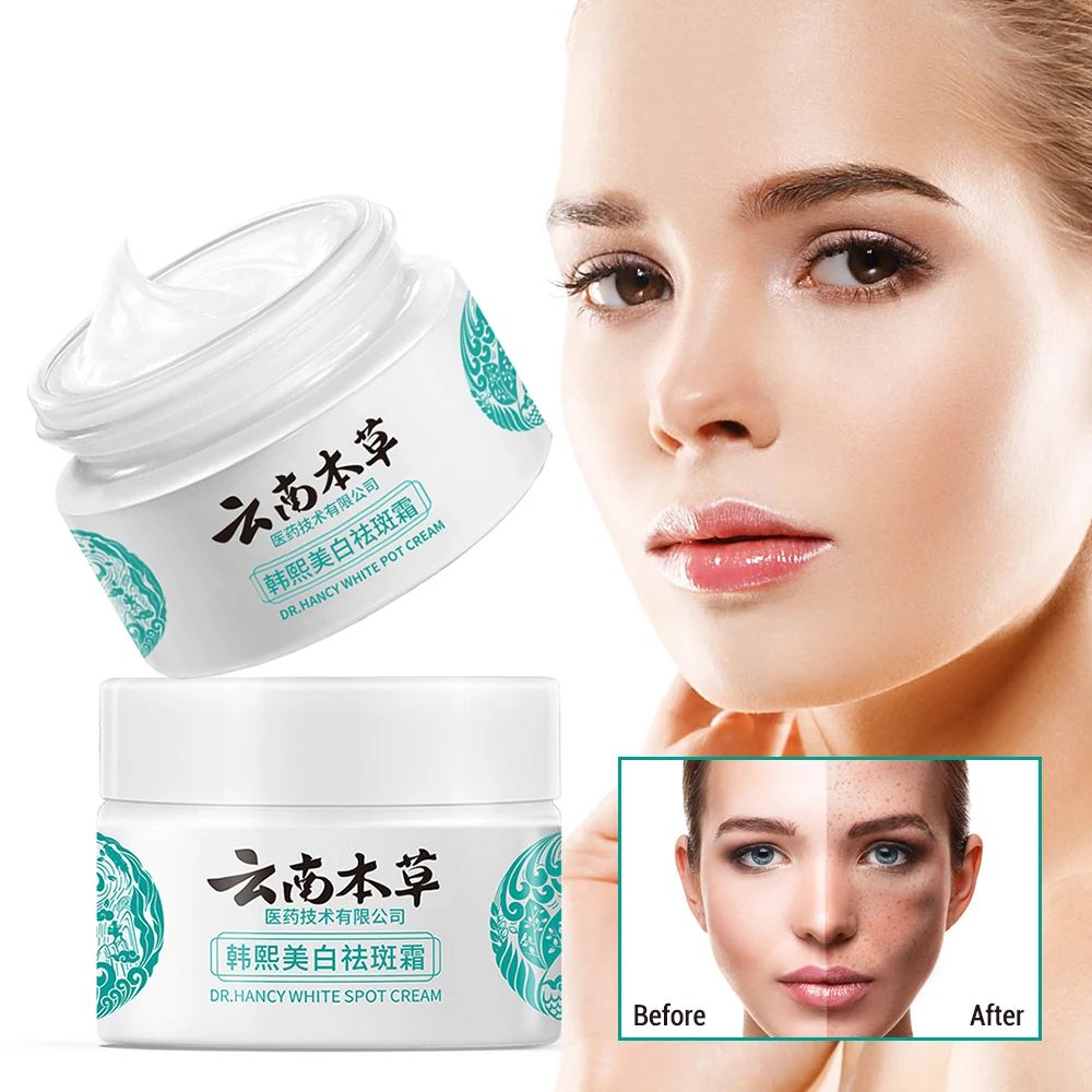 Whitening Freckles Cream Dark Spot Lightening Melanin Removal Melasma Remover Moisturize Brighten Face Skin Care 20g