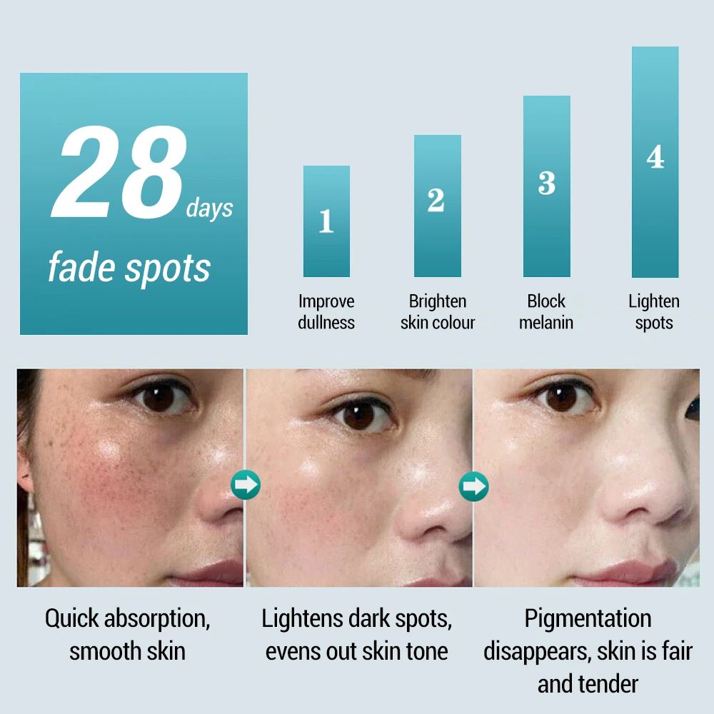 Whitening Freckles Cream Dark Spot Lightening Melanin Removal Melasma Remover Moisturize Brighten Face Skin Care 20g