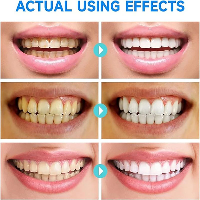 Probiotic Caries Toothpaste SP4 Whitening Repair Tooth Decay Paste Cleaner Teeth Remover Plaque Fresh Breath Oral Care