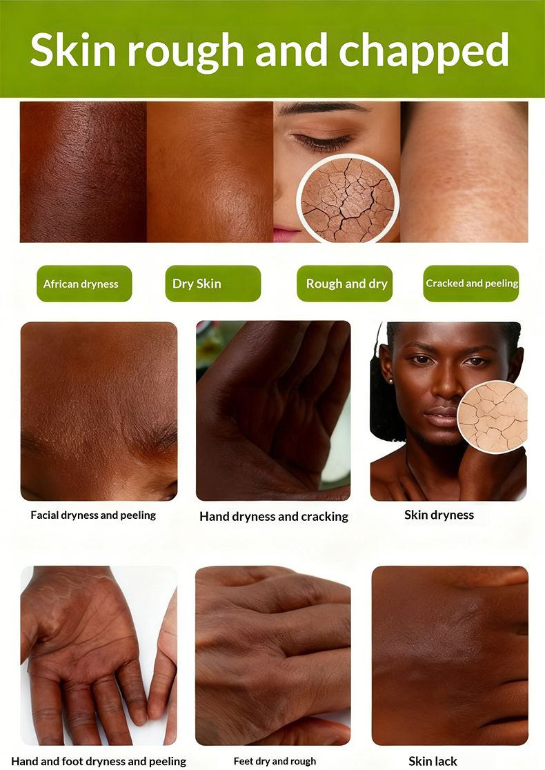Kitoo Super Whitening Body Oils