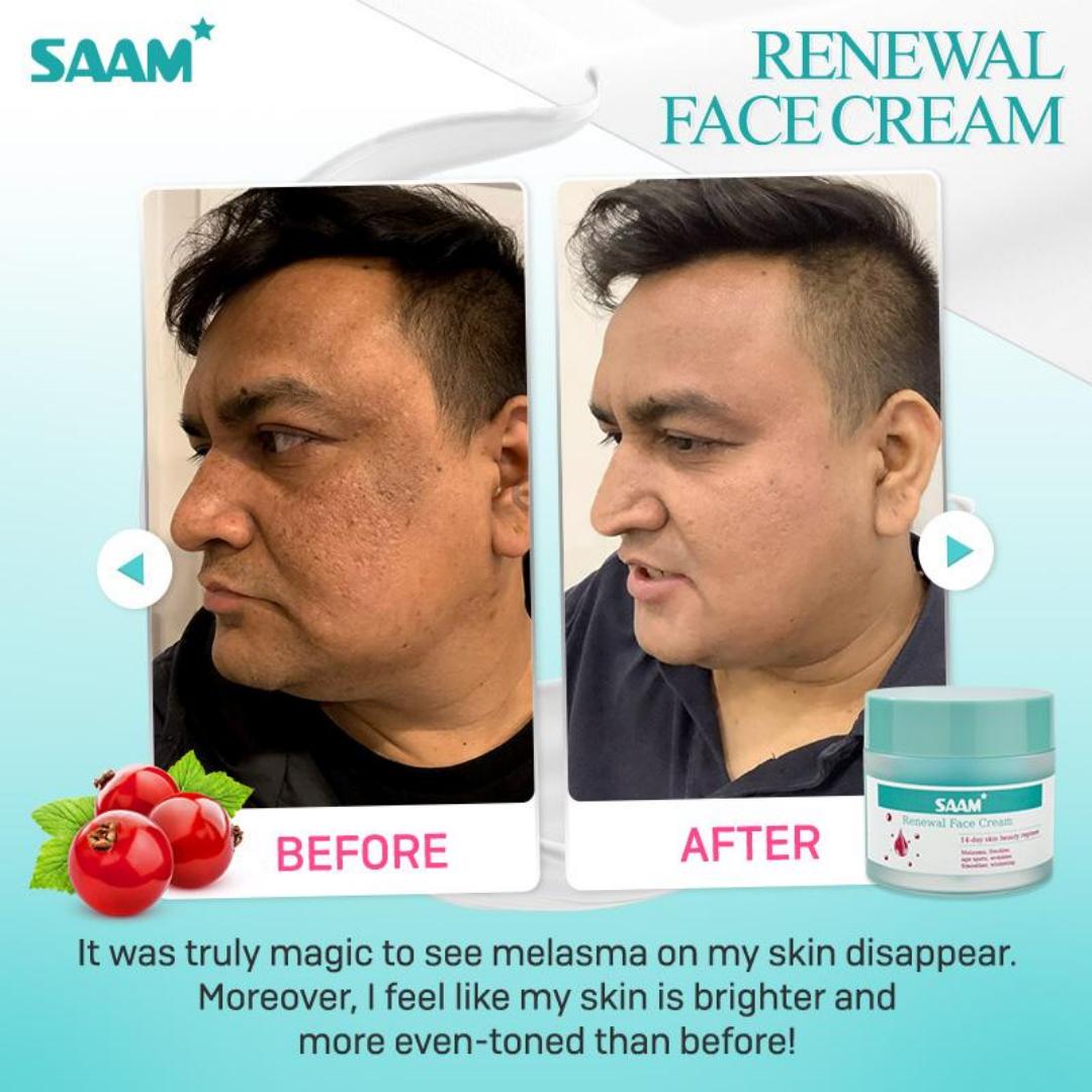 Skin renewal face cream Is Designed For Individuals Looking To Revitalize Their Skin Within A Short Time Frame.