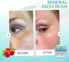 Skin renewal face cream Is Designed For Individuals Looking To Revitalize Their Skin Within A Short Time Frame.