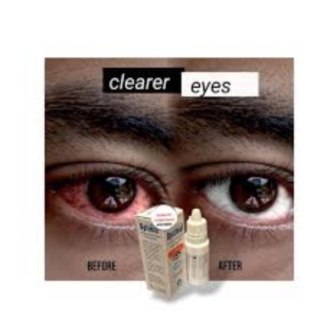 Optimal Sterile Eyedrops Brighter Clear Eyes!!NEye Whitening Clear Redness Eyedrops For Red Eyes Whitens Moisturises Soothes