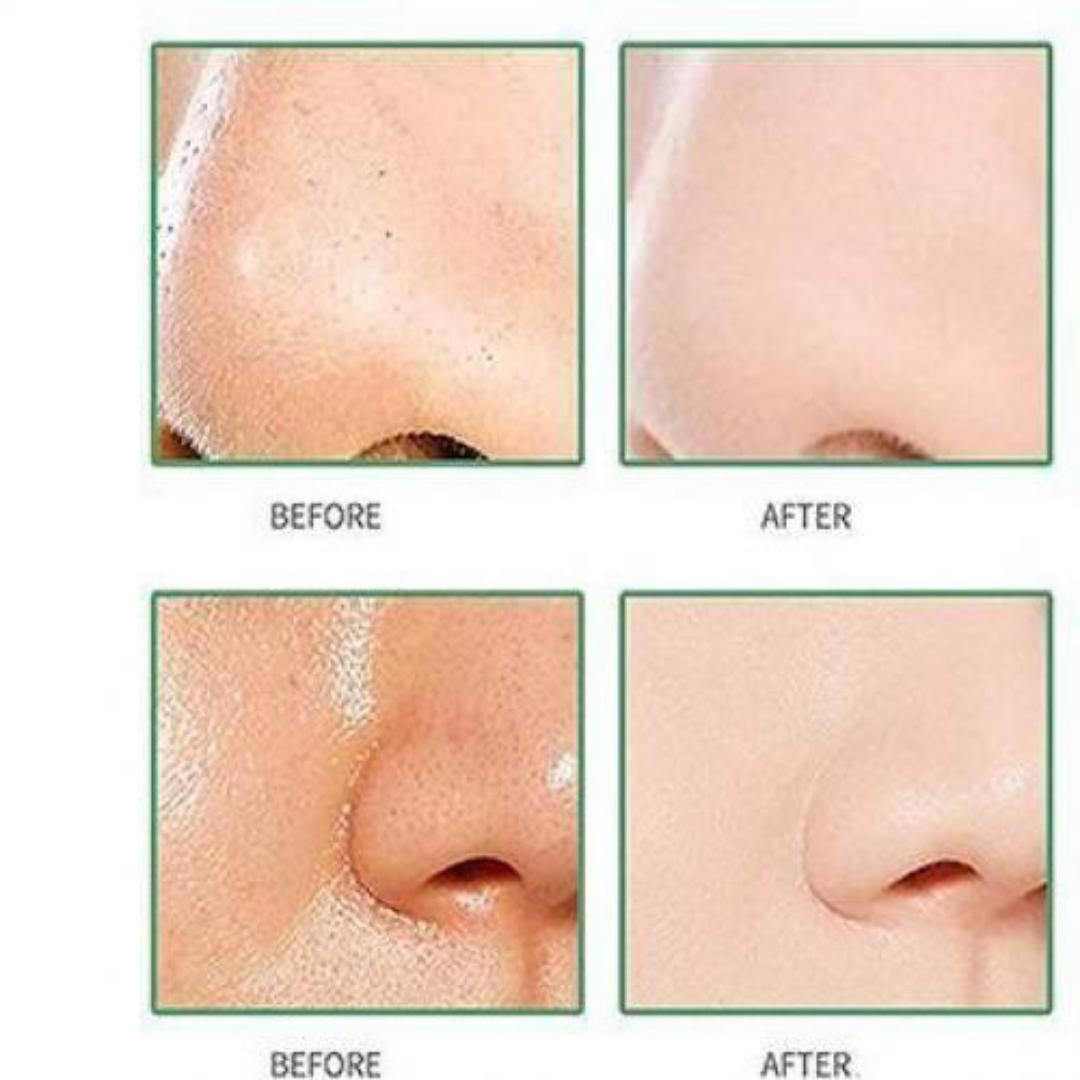 Green Tea Mask Mud Stick Under Eye Blackness Dark Circles Redness Sunburn Antiaging Promote Collagen Skin Clarity Acne Blackhead Smooth Clear Complexion Tighten Pores Clay Stick Mask