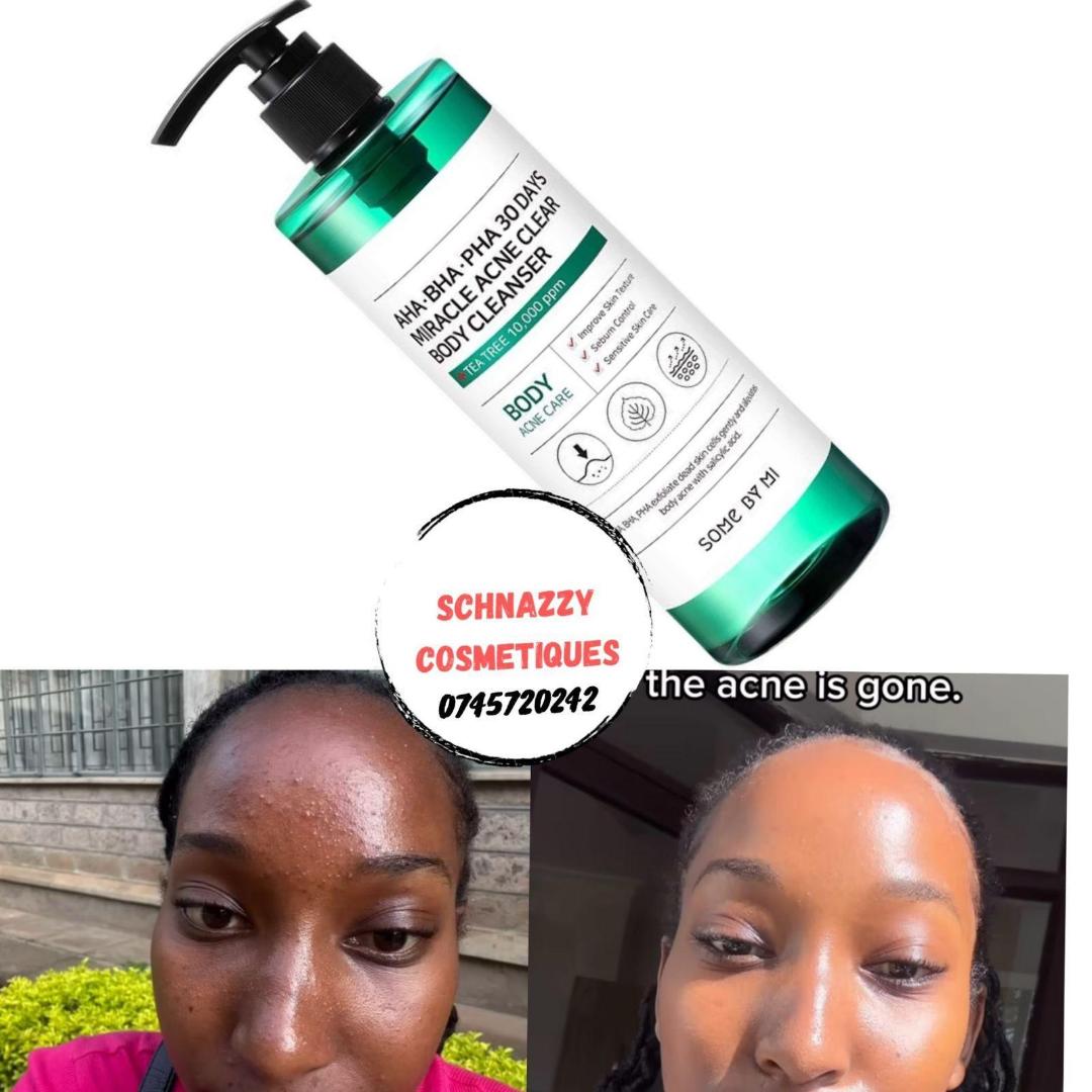 Best price for AHA BHA PHA Miracle Solution Acne Body Cleanser - Quick ...