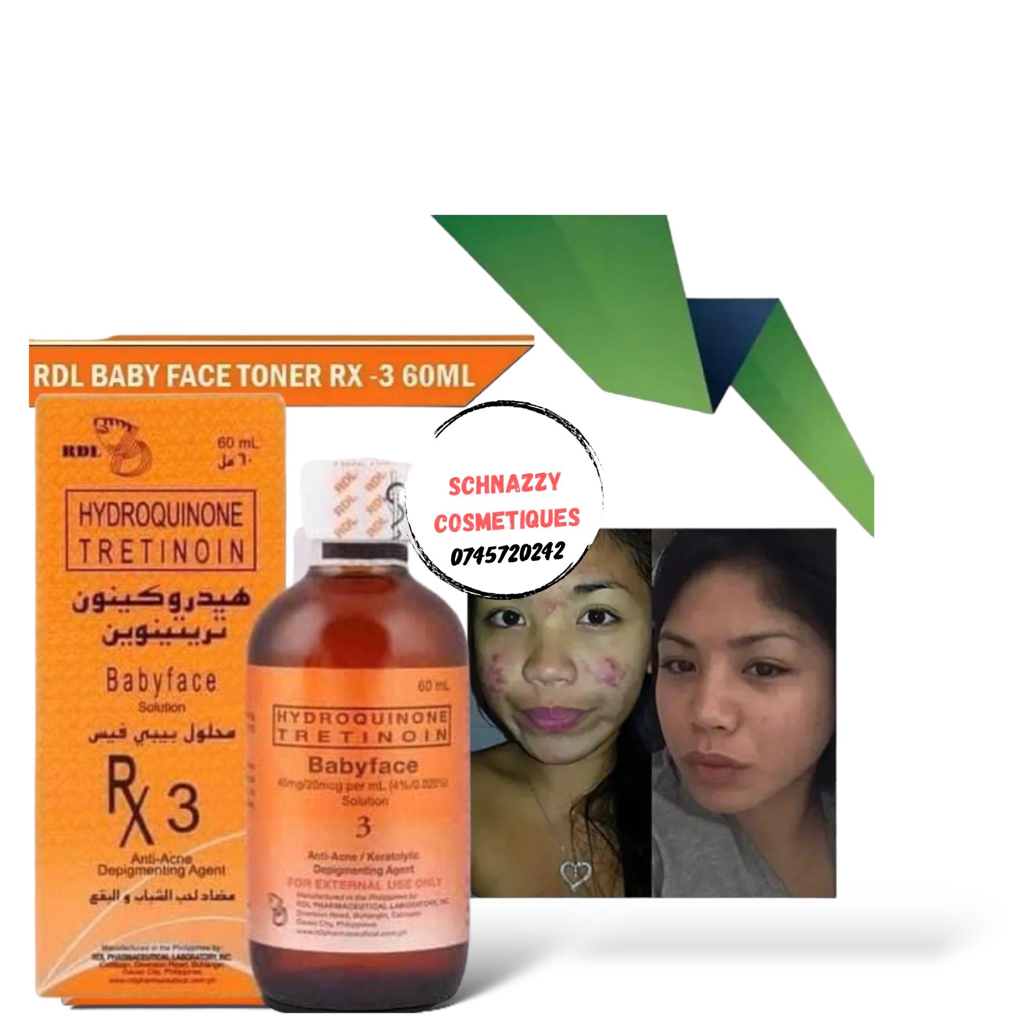 RDL RX2 Hydroquinone Tretinoin Anti Acne Babyface Solution for Hyperpigmentation Scars Dark Spots Blemishes Sunburn Dark Circles Blackness Treatment and soap