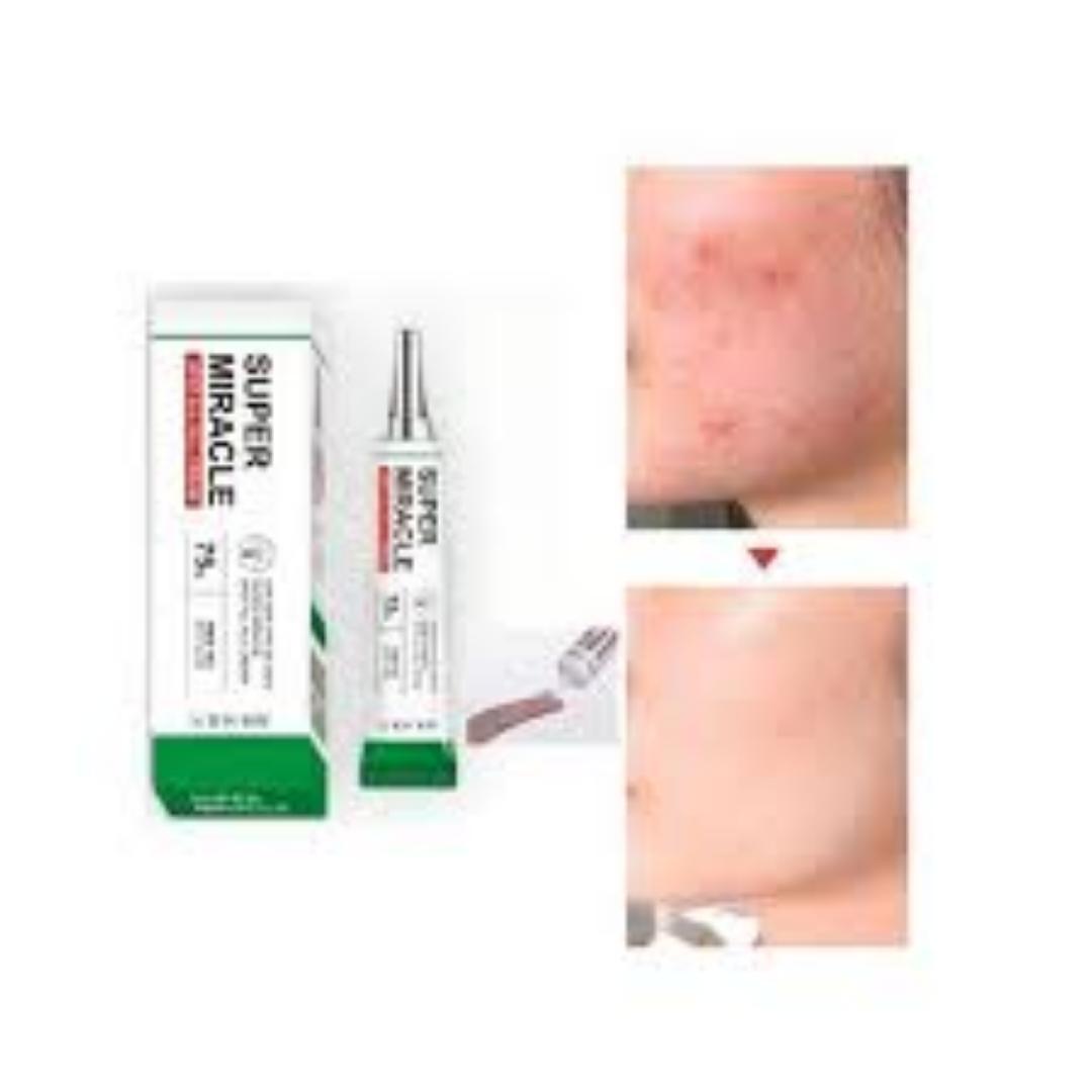 AHA BHA PHA Super Miracle Spot Remover Cream Tea Tree Spot Clear for Sensitive Skin Calming Protection (with Niacinamide, Kojic, Hyaluronic Acid)
