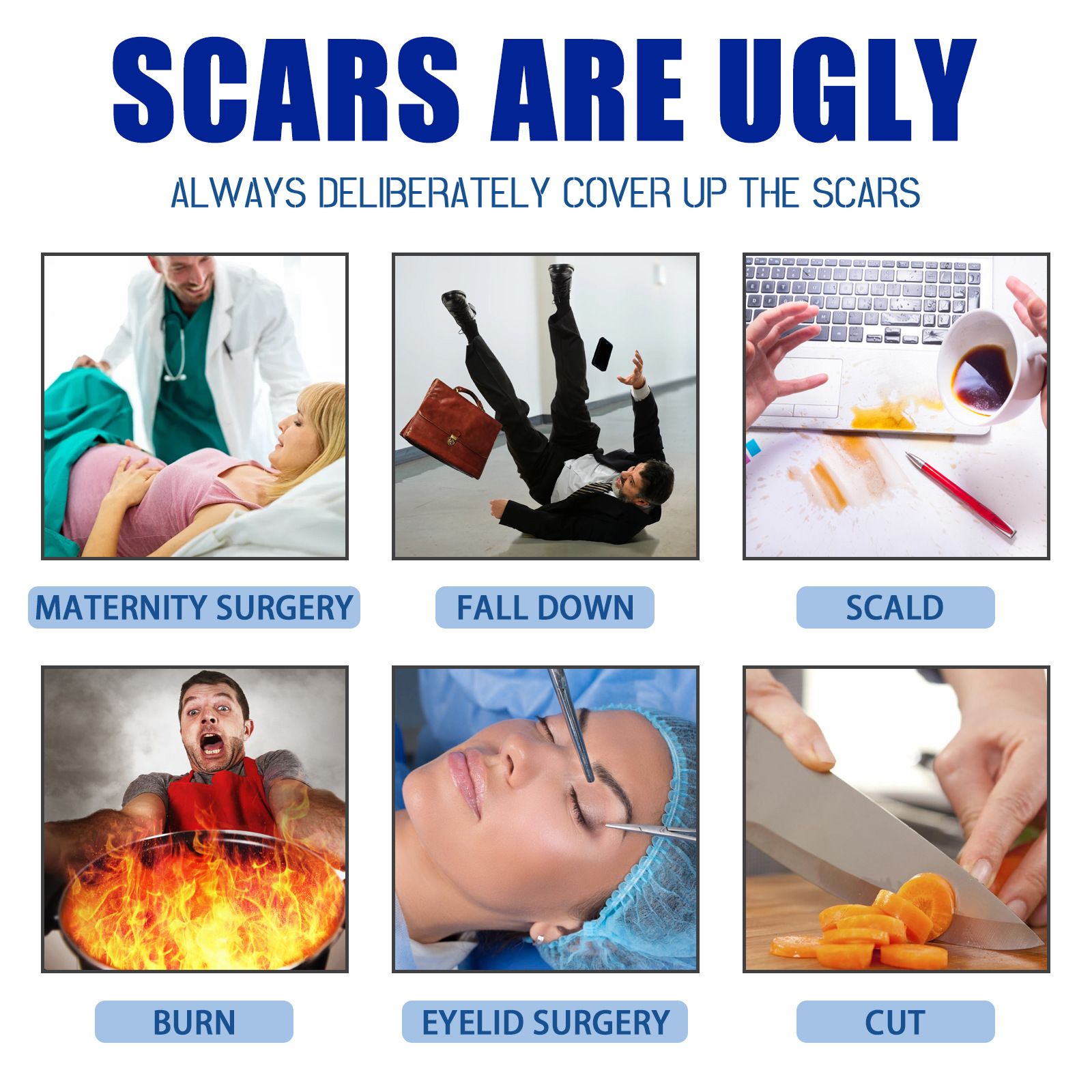 Scar removal  Gel，Advance Scar Gel，Advanced Formula Scar Gel for Old & New Scars, Acene, C-Section, Stretch Marks, Old and New Scars ,Keloids Scar Removal Cream (2PCS)