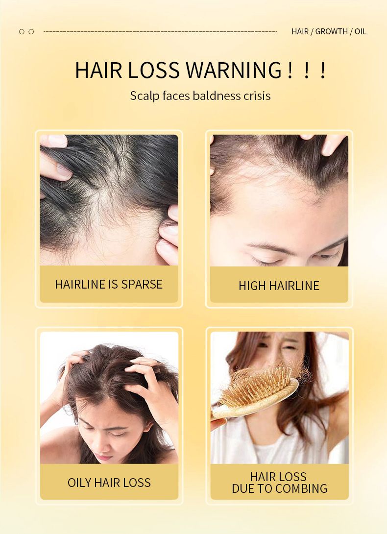 Natural Hair Growth Oil, Zingiber Officinale,Rosemary Oil for Hair Growth Organic, Veganic Natural Hair Growth Oil for Thin Hair, Hair Oil for Dry Damaged Hair and Growth，60ml