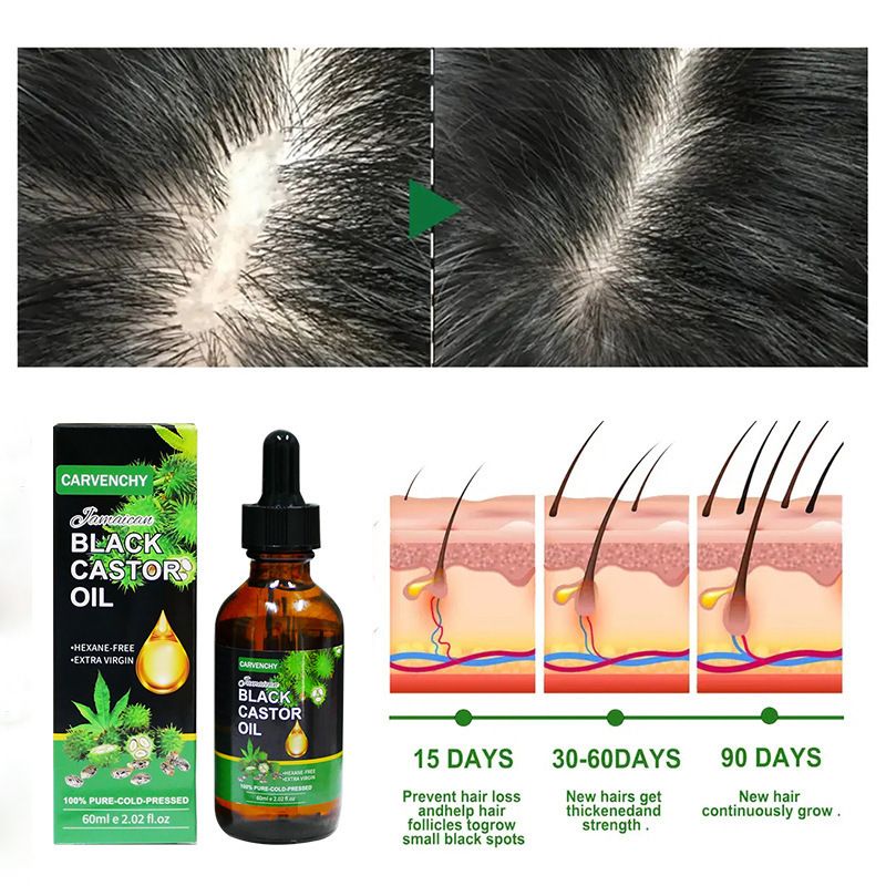 Jamaican Black Castor Oil - 100% Pure and Organic, Cold Pressed in Glass Bottles for Hair Growth, Eyebrow Nourishment, and Skin Hydration，Hair loss prevention