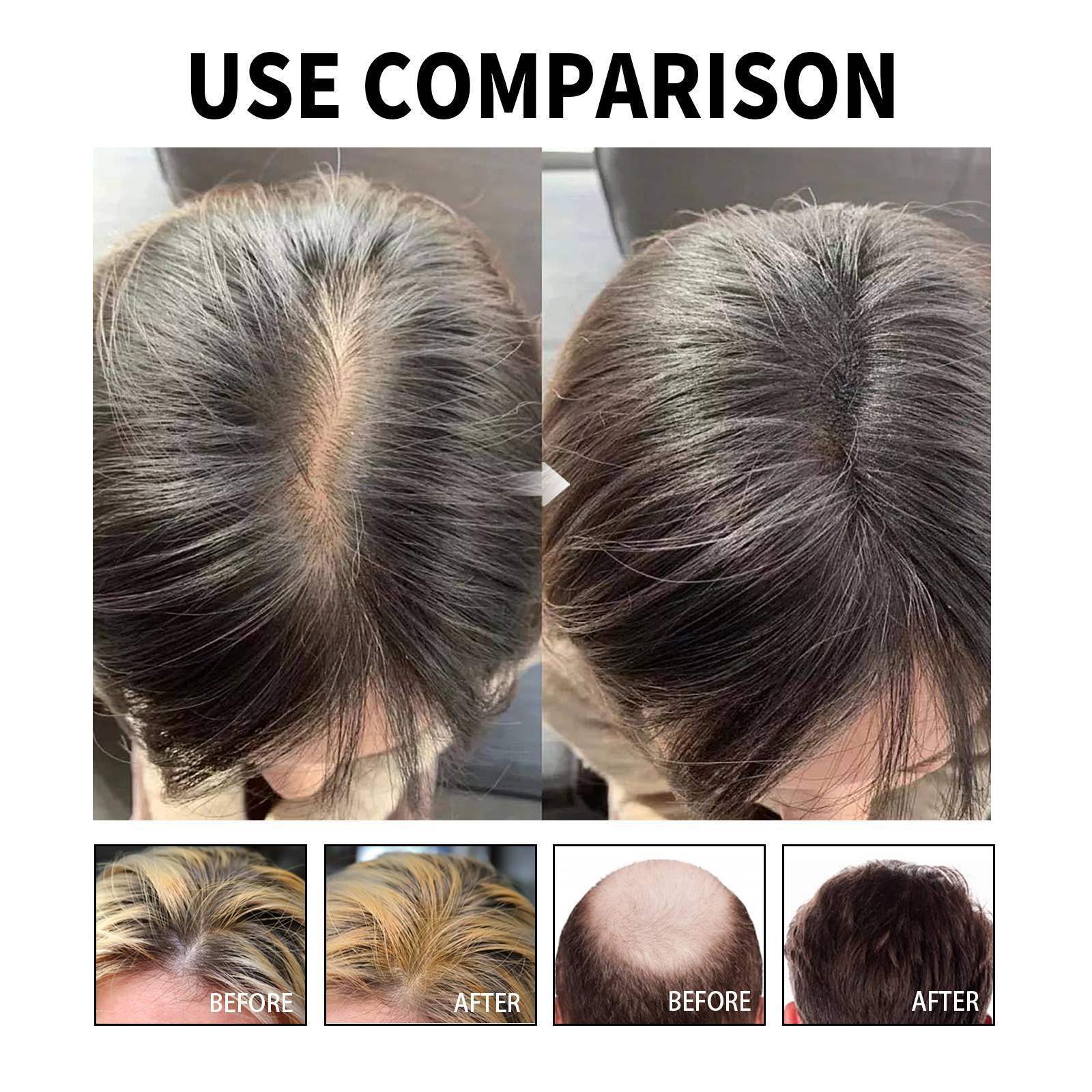 Jamaican Black Castor Oil - 100% Pure and Organic, Cold Pressed in Glass Bottles for Hair Growth, Eyebrow Nourishment, and Skin Hydration，Hair loss prevention