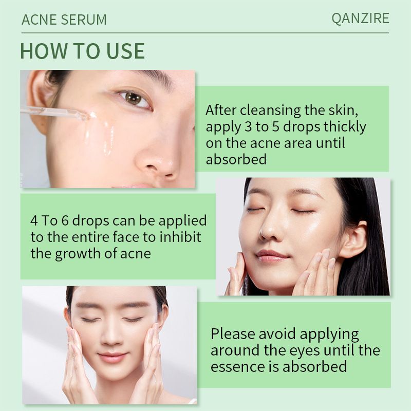Acne Treatment Serum with 2% Salicylic Acid & Niacinamide-Precision Acne Spot Serum, Acne Drying Lotion, Overnight Acne Treatment For Face, Dry Out Pimples, Blemishes, Zits And Clean Pores, 0.42 Fl O
