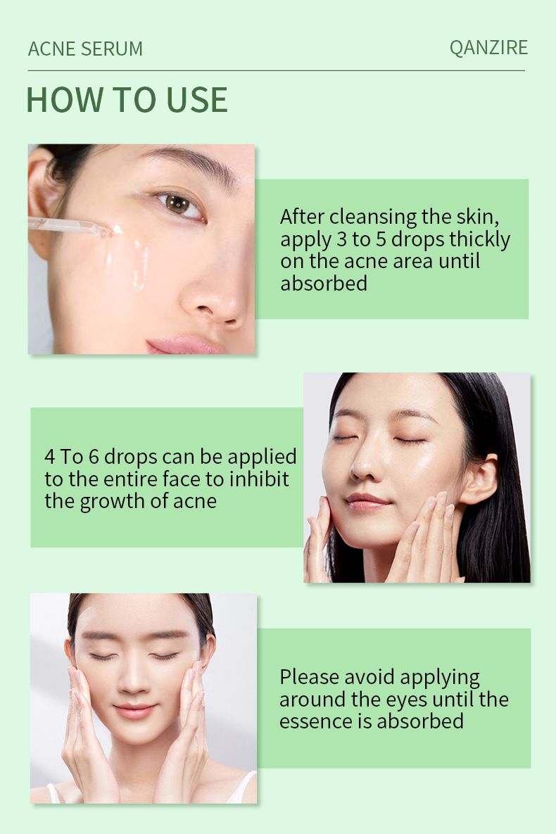 Acne Treatment Serum with 2% Salicylic Acid & Niacinamide-Precision Acne Spot Serum, Acne Drying Lotion, Overnight Acne Treatment For Face, Dry Out Pimples, Blemishes, Zits And Clean Pores, 0.42 Fl O