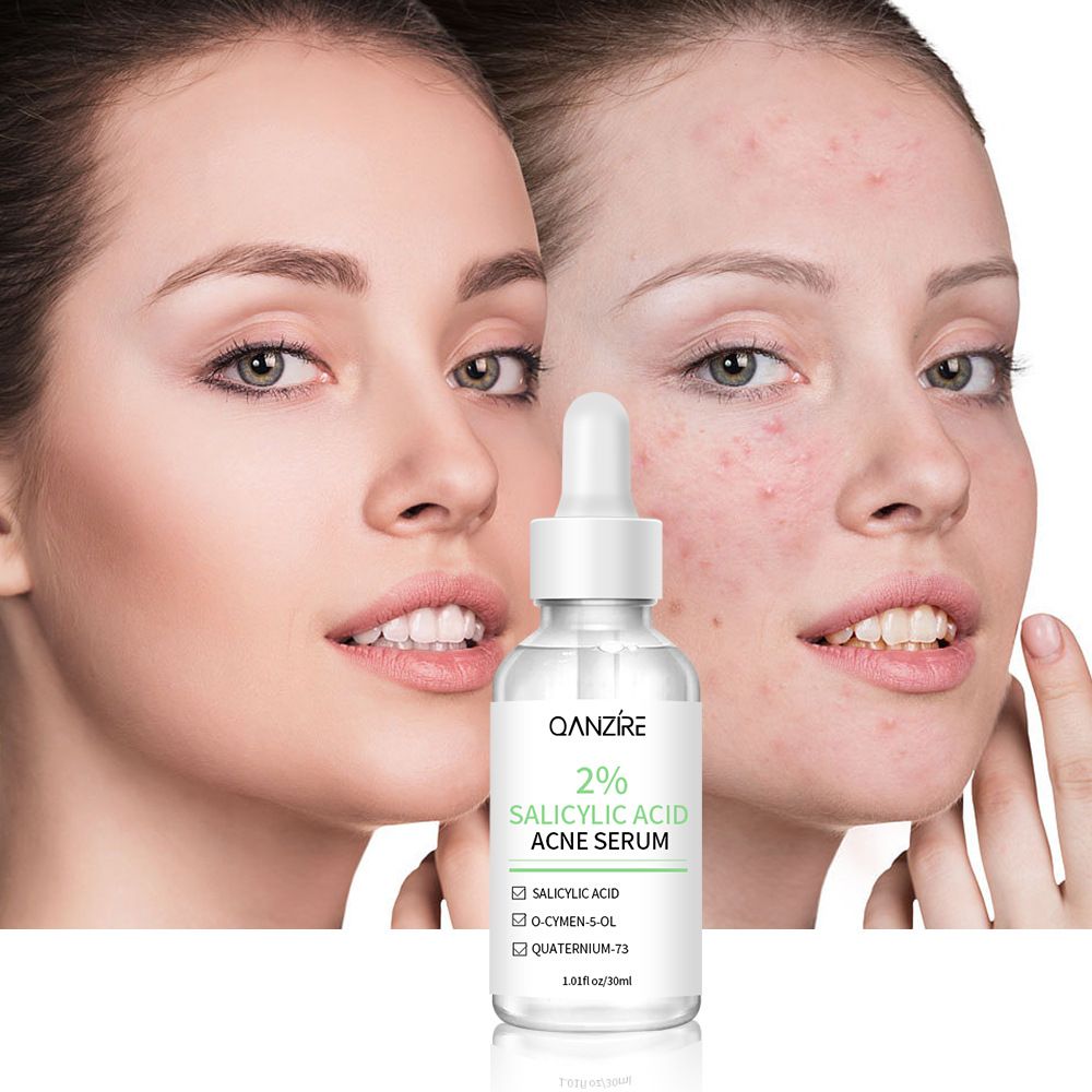 Acne Treatment Serum with 2% Salicylic Acid & Niacinamide-Precision Acne Spot Serum, Acne Drying Lotion, Overnight Acne Treatment For Face, Dry Out Pimples, Blemishes, Zits And Clean Pores, 0.42 Fl O