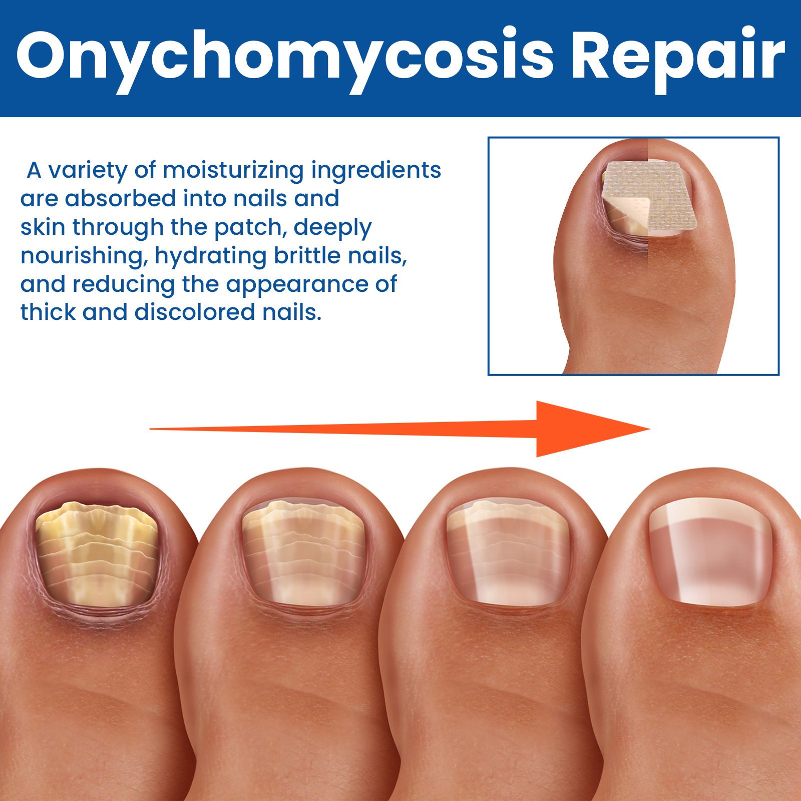 Toenail Fungus Cleansing Extra Strength,60pcs Fungal Nail Patches 8-Hour Overnight Nail Repair Effortless Restore Healthy Nail Appearance