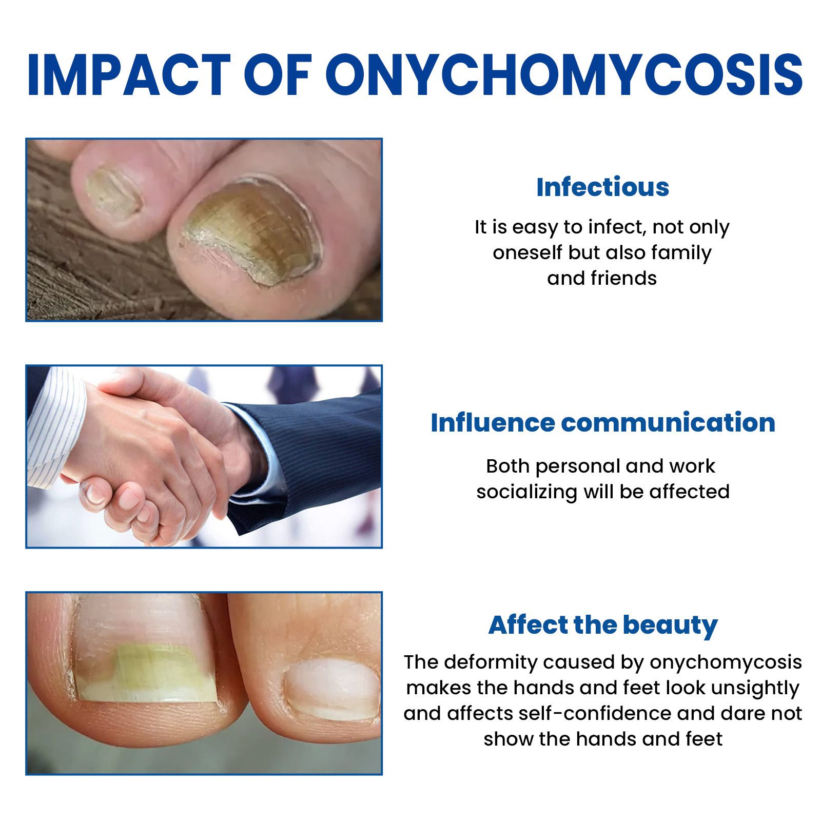 Toenail Fungus Cleansing Extra Strength,60pcs Fungal Nail Patches 8-Hour Overnight Nail Repair Effortless Restore Healthy Nail Appearance