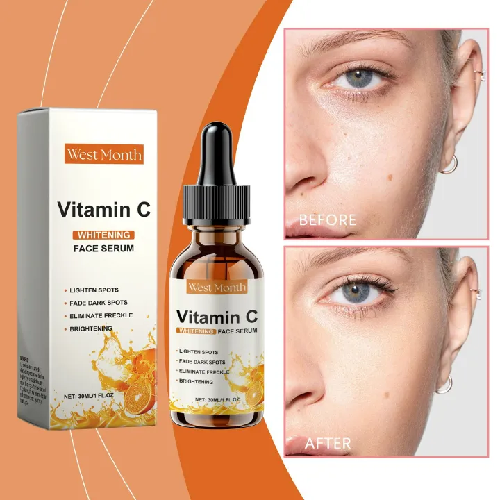 Vitamin C Serum For Face – Anti Aging Formula with Vitamin C, Hyaluronic Acid, Vitamin E – Brightening Serum – Improve Appearance of Dark Spots, Tone, Fine Lines & Wrinkles