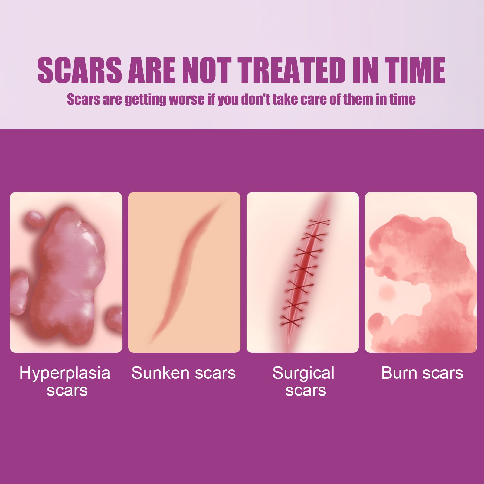 Scar Removal Cream for Men and Women, Ouhoe Scar Cream Smoothing Firming and Fading, Advanced Scar Gel for Face Body Leg, Fast Results, Gentle for All Skin Types