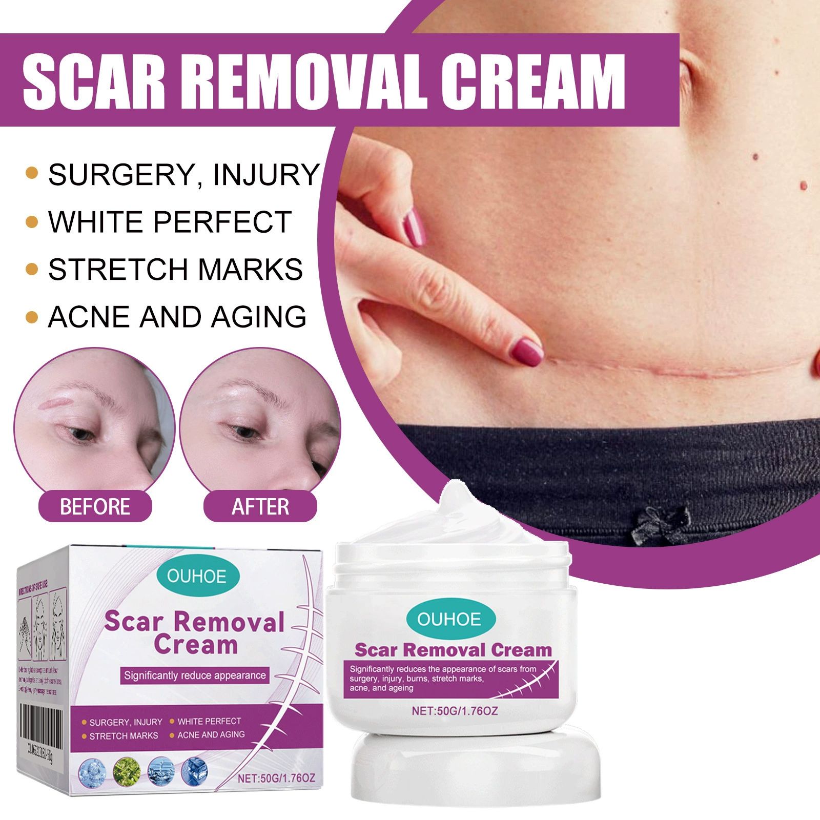 Scar Removal Cream for Men and Women, Ouhoe Scar Cream Smoothing Firming and Fading, Advanced Scar Gel for Face Body Leg, Fast Results, Gentle for All Skin Types