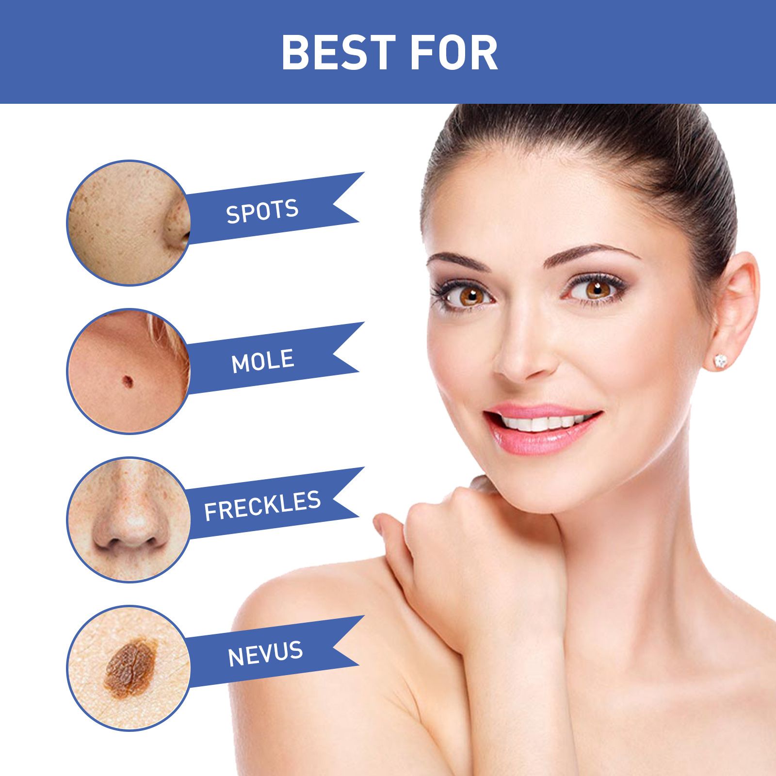 Warts Remover Antibacterial Ointment Wart Treatment Cream Skin Tag Remover Herbal Extract Corn Plaster Warts Ointment