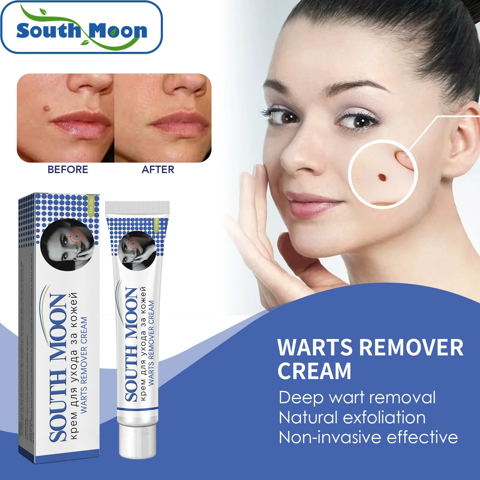 Warts Remover Antibacterial Ointment Wart Treatment Cream Skin Tag Remover Herbal Extract Corn Plaster Warts Ointment