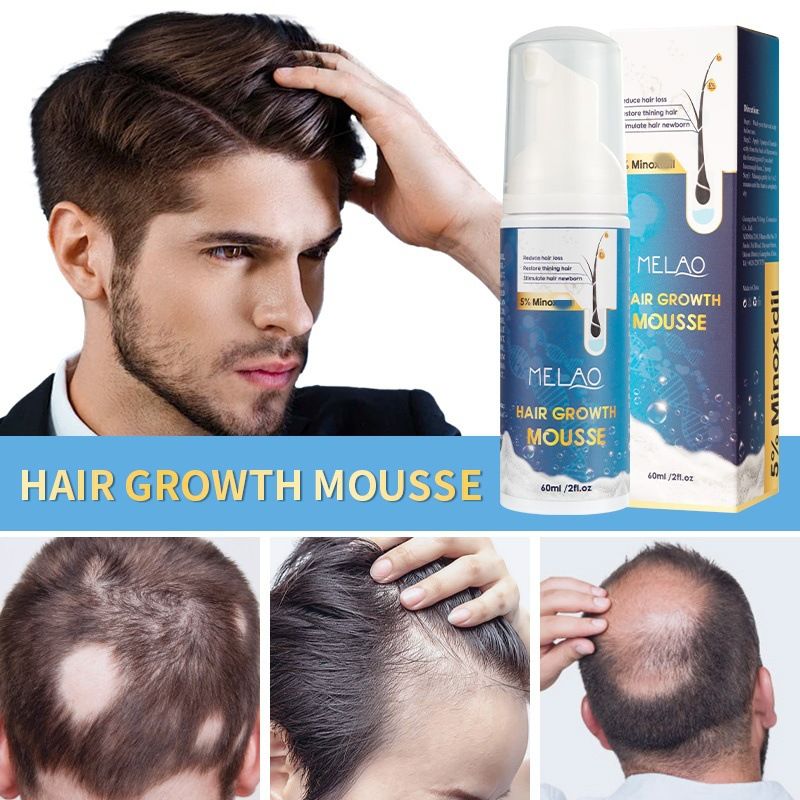 Generic Melao 5% Minoxidil for men&women Hair growth serum Oil for men beard Save hair loss Vegan without harmful chemicals Biotin Hair Regrowth Natural Hair Growth for Thicker Fuller Healthier Hair