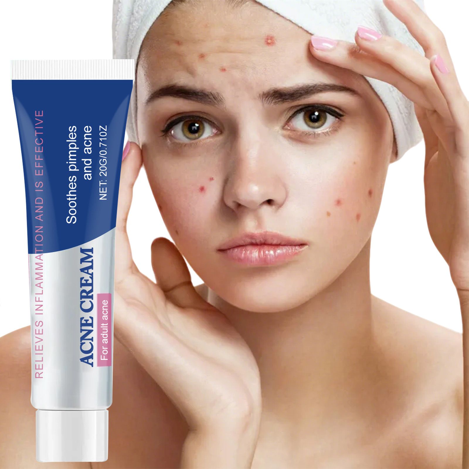 Herbal Acne Face Cream Pimple Scar Remover Cream Oil Control Shrink Pore Pockmark Smooth Acne Marks Facial Cream Skin Care Product - BIOAQUA-