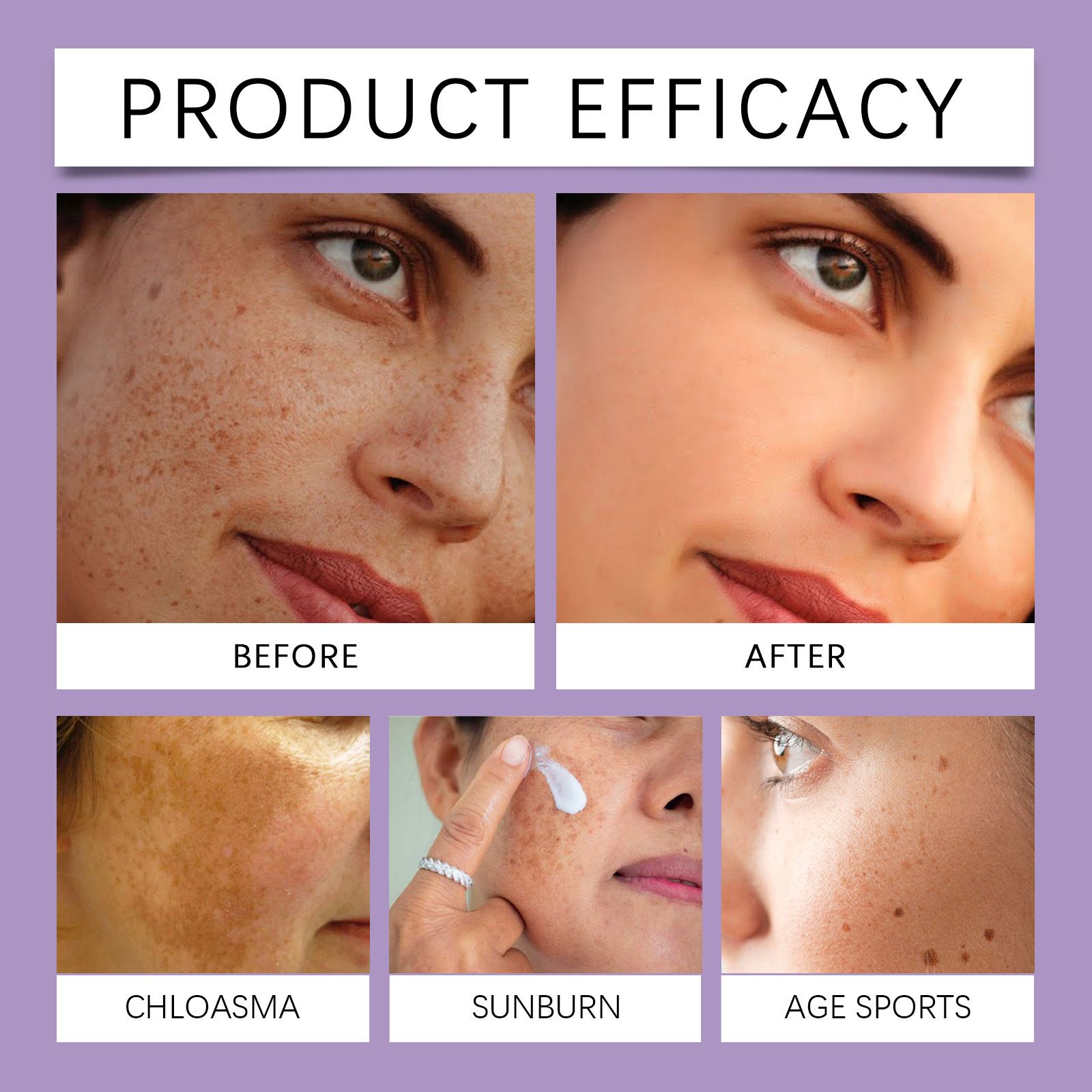 Advanced Resist-Hyperpigmentation Cream Cream For Hyperpigmentation Resist Aging Face Cream Dark Speckle Remover Dark Speckle Cream Dark Speckle Corrector 30g