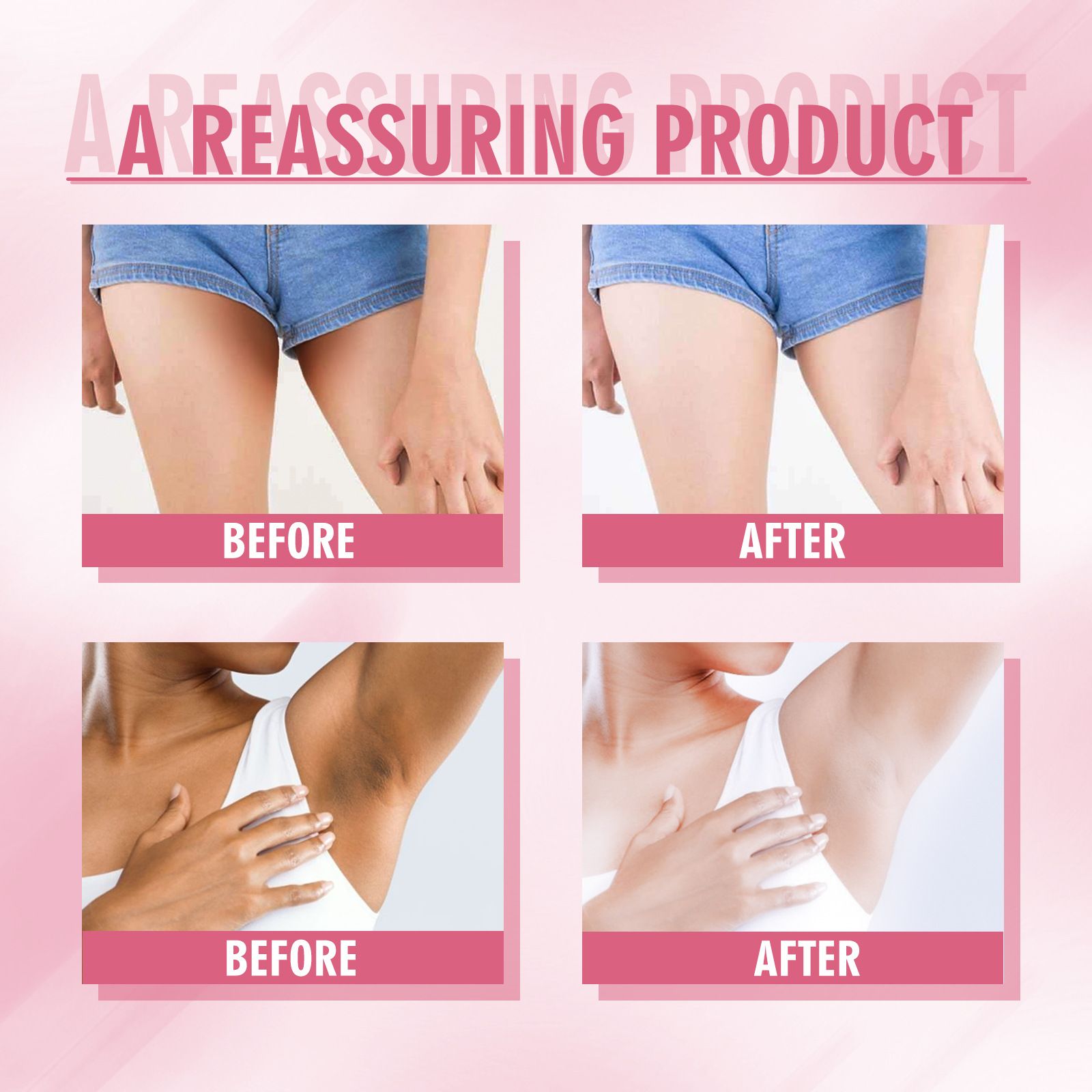 Skin Lightening Cream for Body, Underarm, Intimate Area, Bikini Area, Inner Thighs, Knees, Elbows, Bleach Skin Bleaching Face Whitening Cream