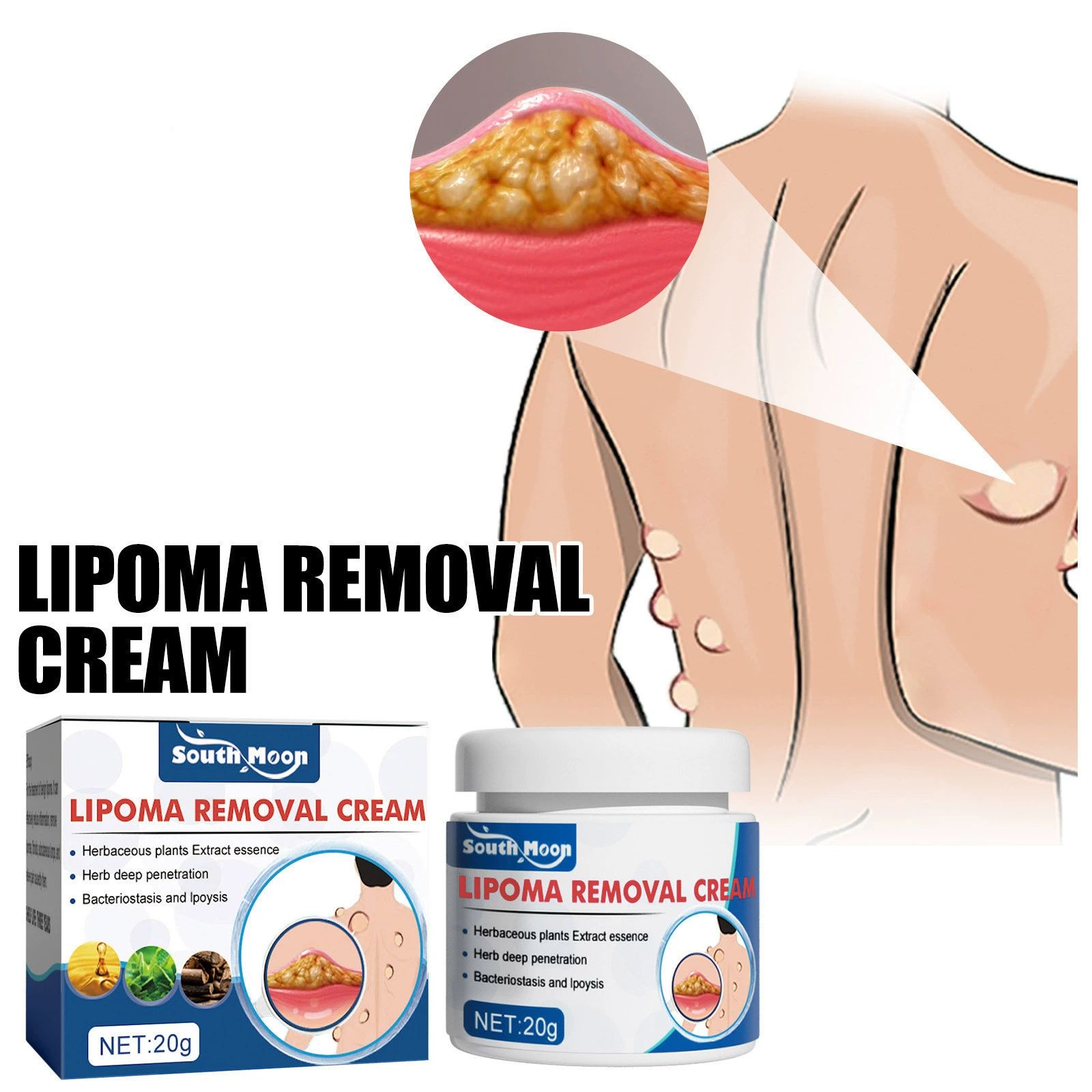 Folliculitis Treatment Cream, Natural Ingredients, Valid Relieve, for Itching, Lichen, Redness, Inflammation, Fast Non-Irritating