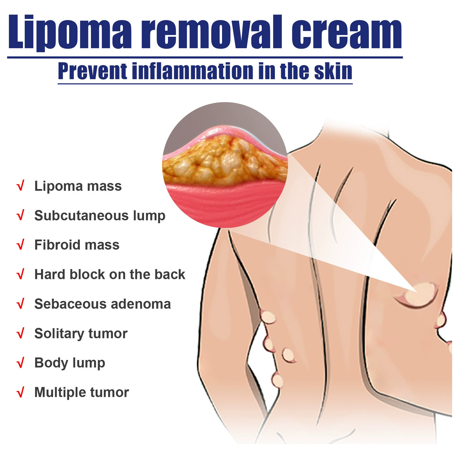 Folliculitis Treatment Cream, Natural Ingredients, Valid Relieve, for Itching, Lichen, Redness, Inflammation, Fast Non-Irritating