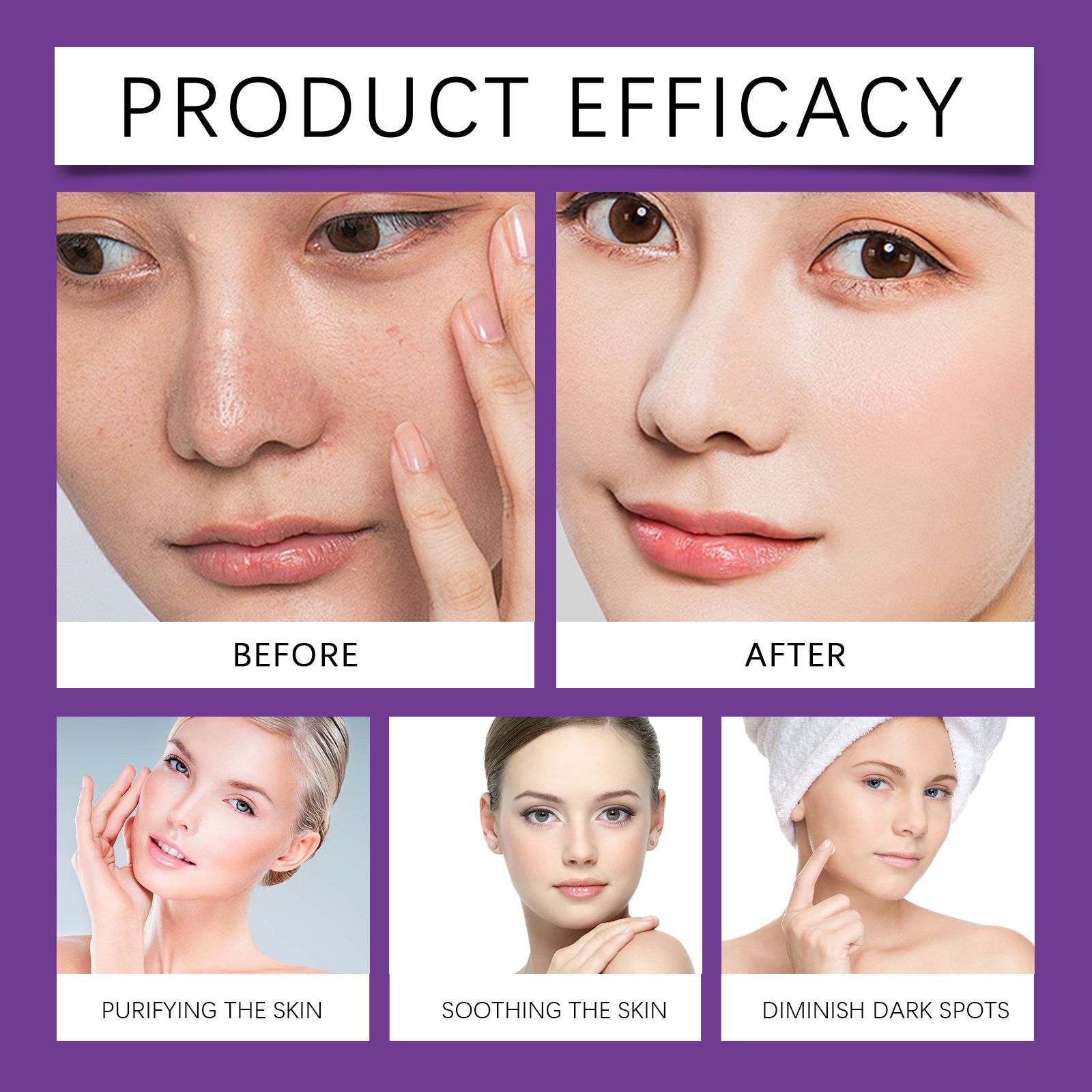 Azelaic Acid Repair Cream - Gentle Facial Moisturizer For Skin Nourishment, Helps Support Skin Barrier, Lightweight Texture​(3PCs)