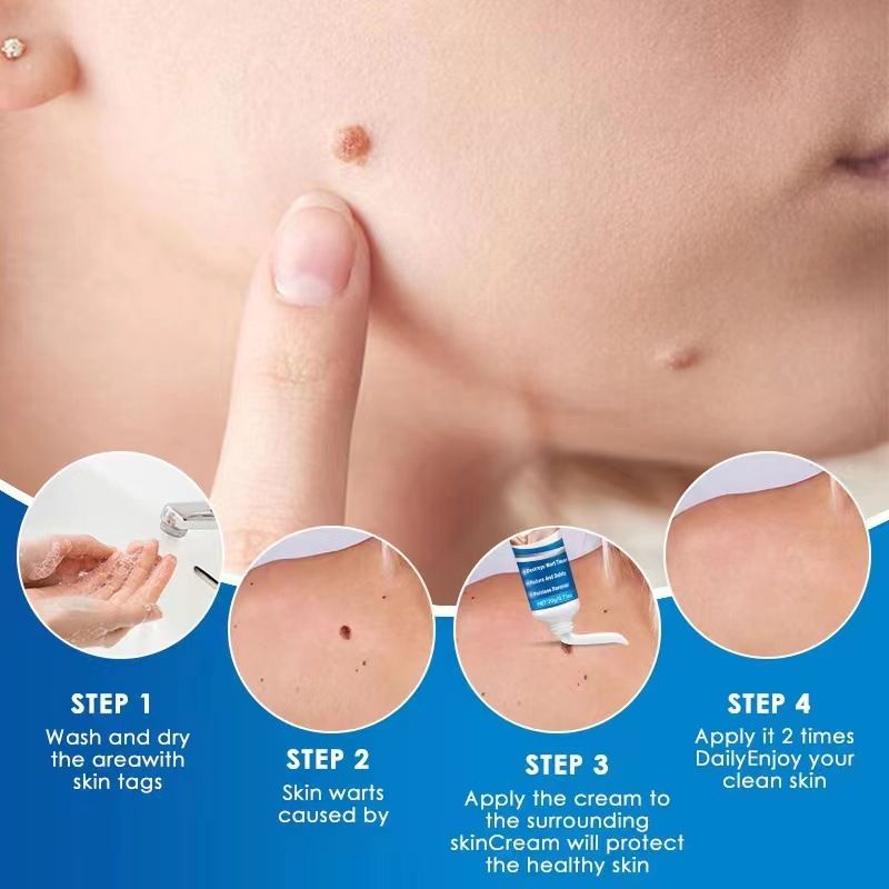Warts Remover Cream, Fast-Acting Wart Ointment with Maximum Strength for Home Use, Safe and Effective